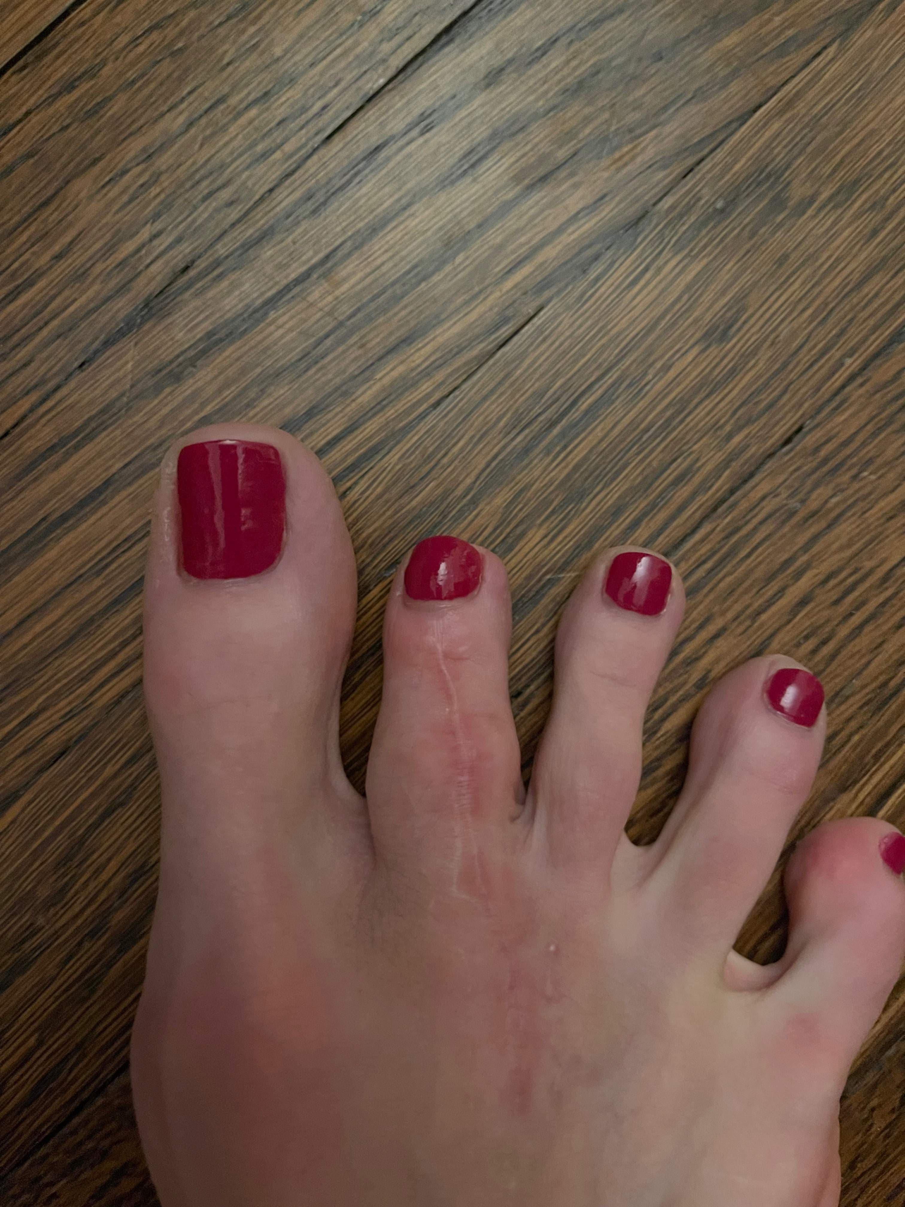 Not your toe bro