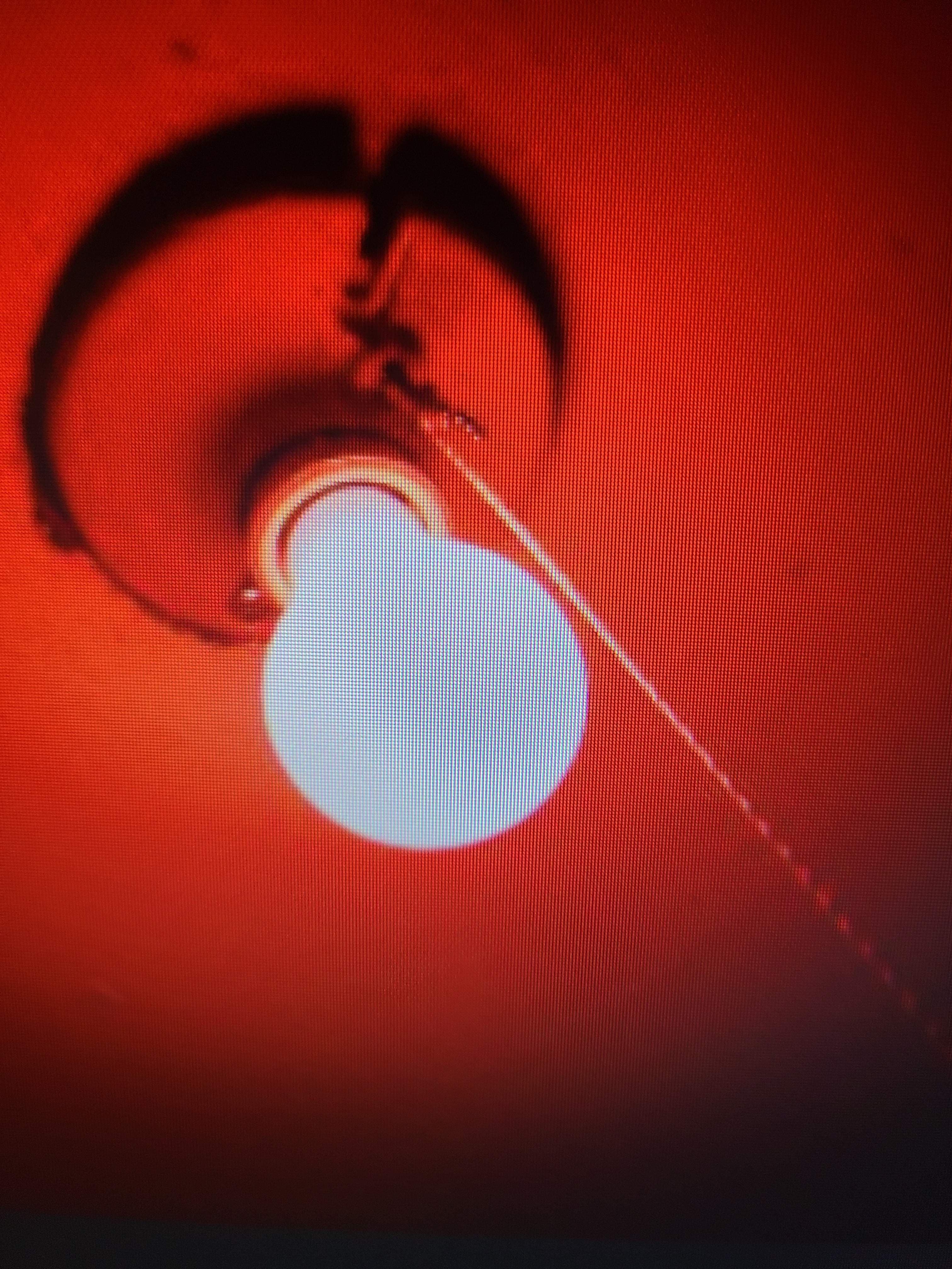 My Red Light District