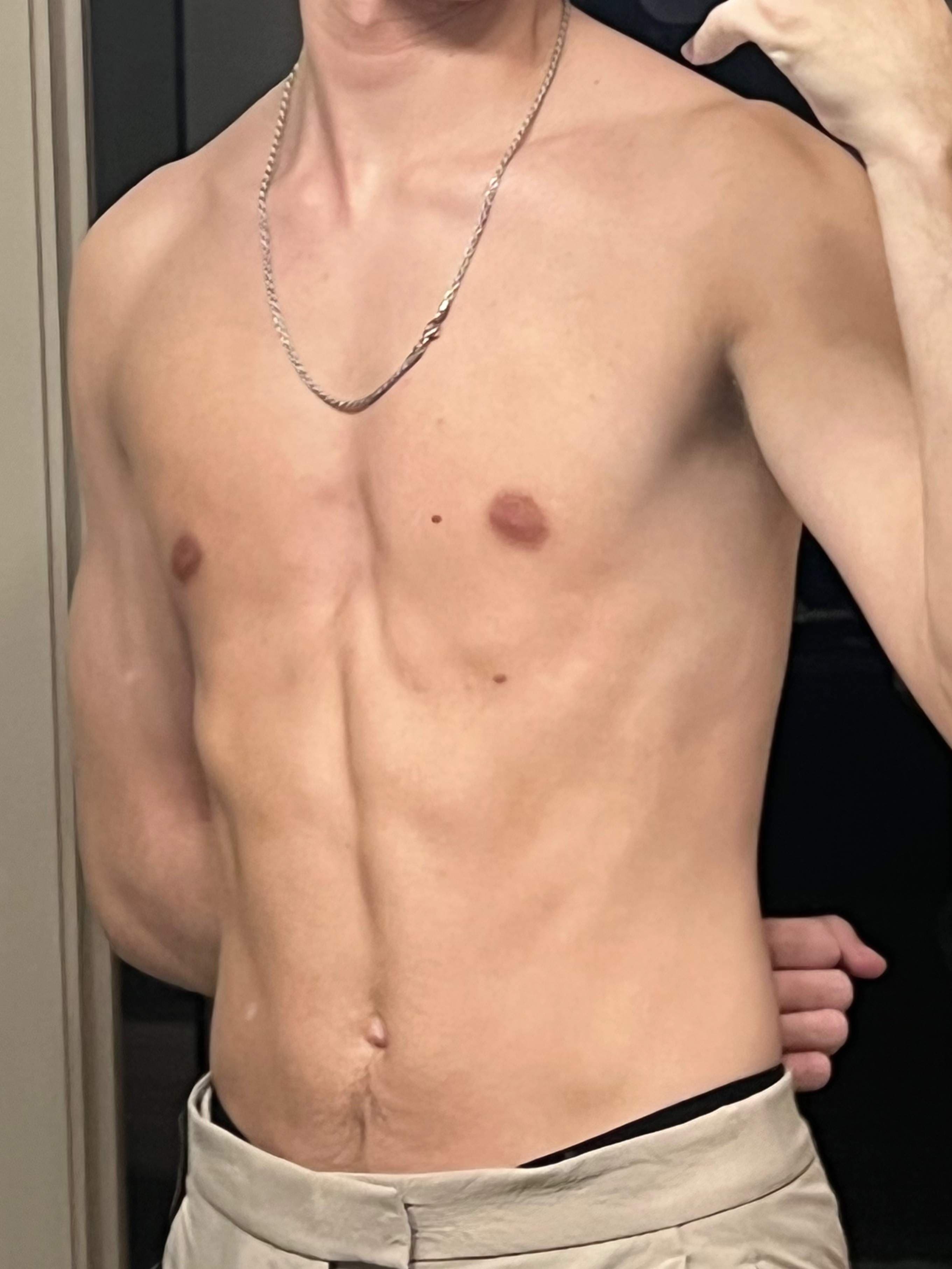 J
