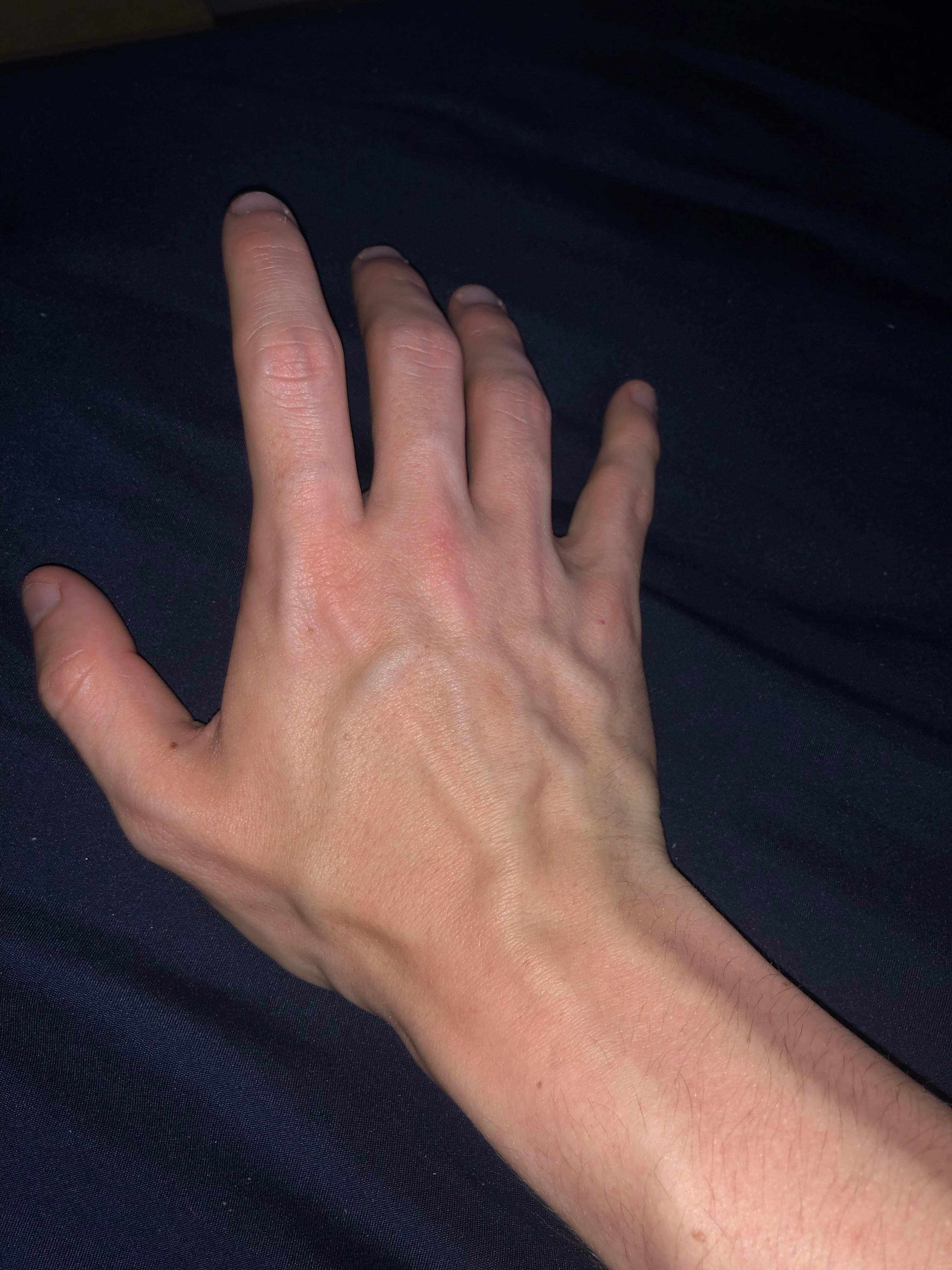 B.