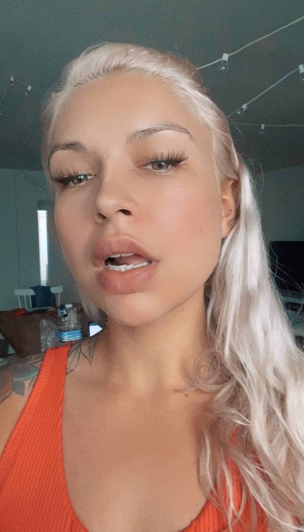 aubs