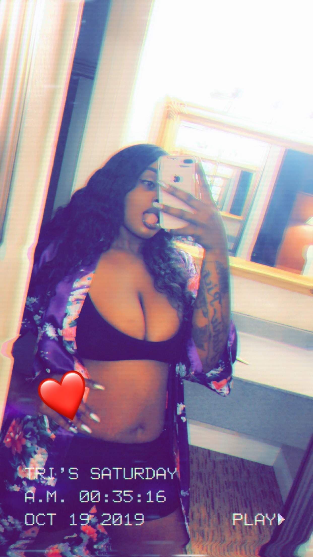 Sugar