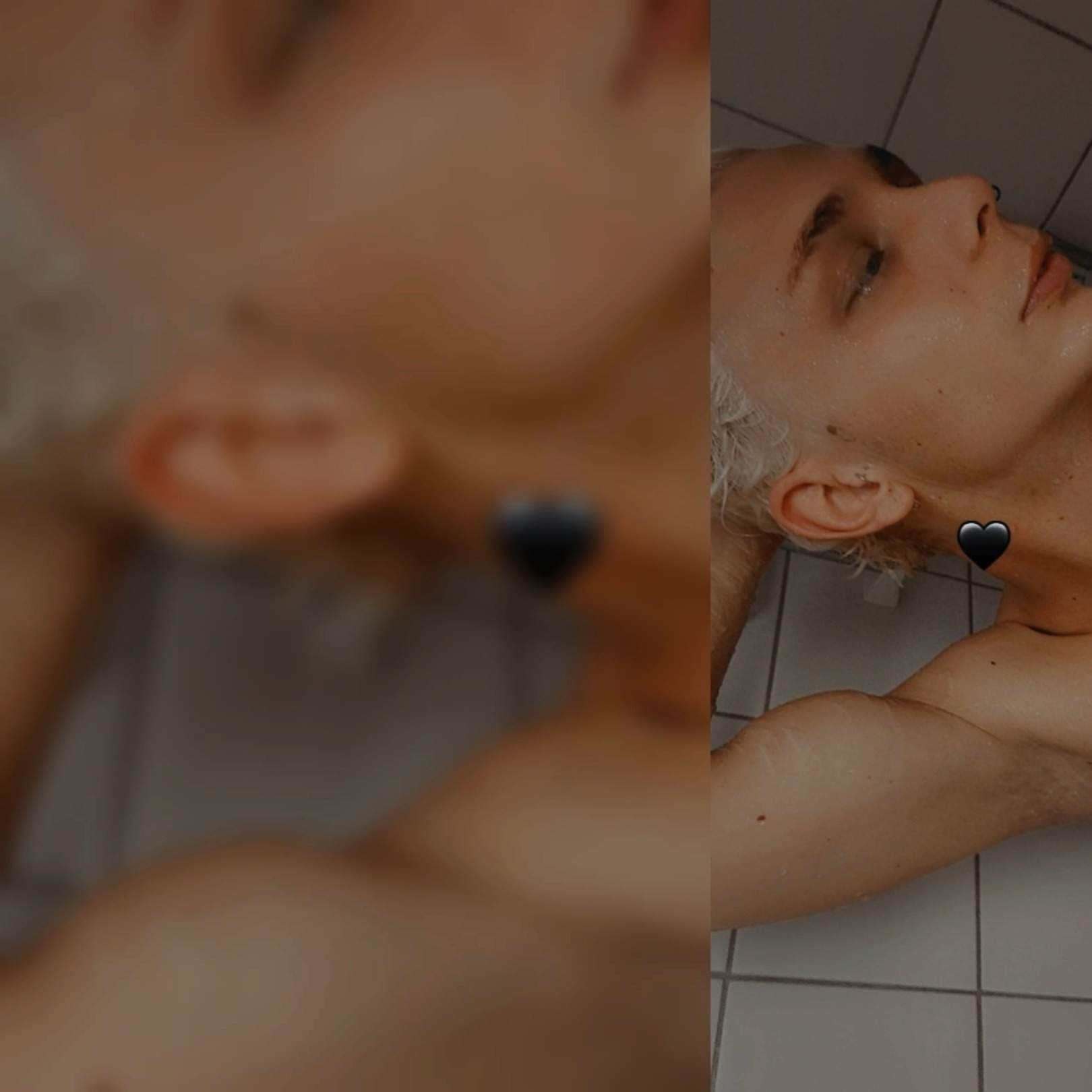 LiP