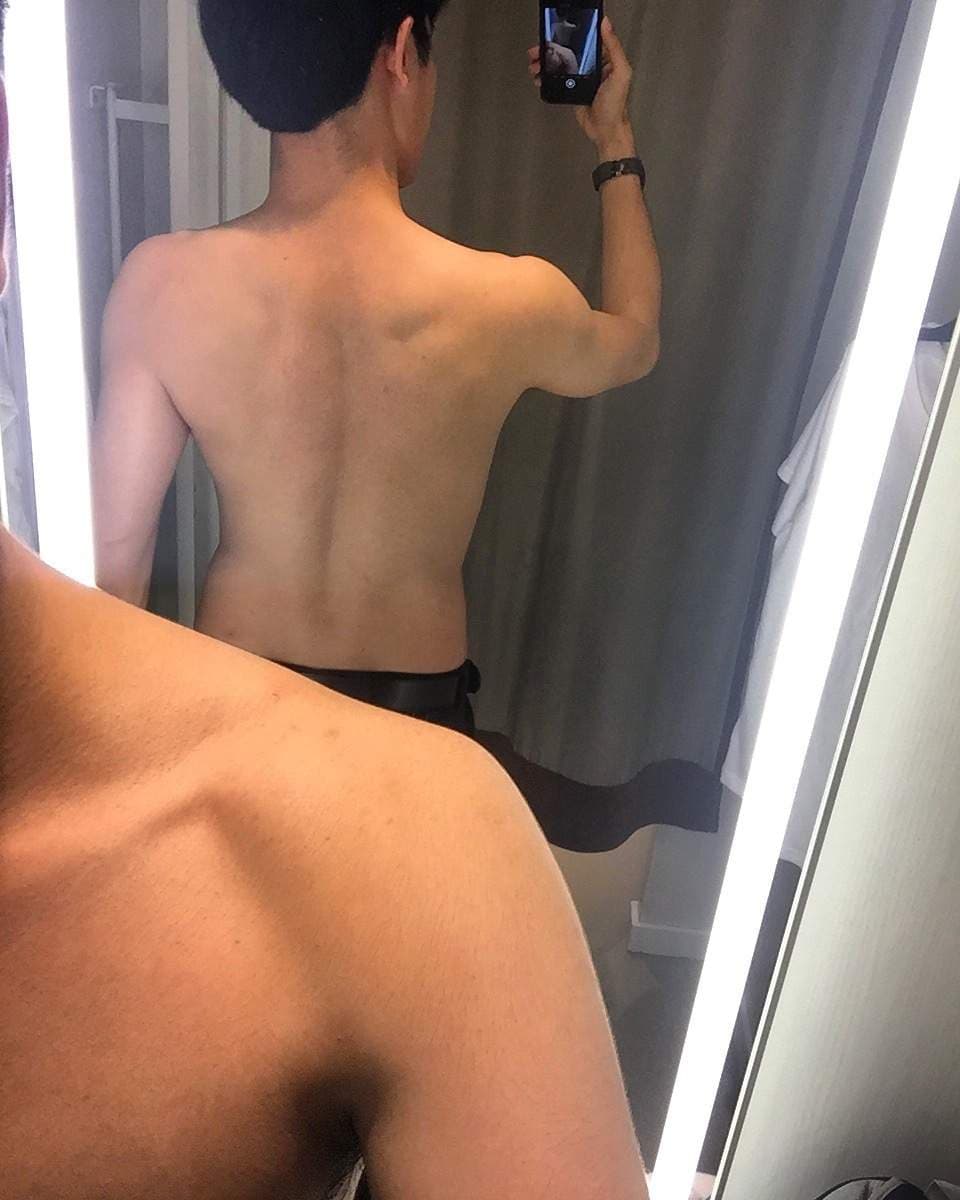 BB