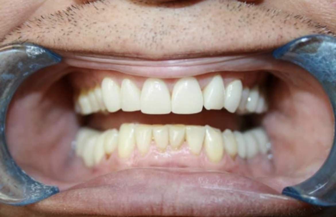 ToothFetish Doc