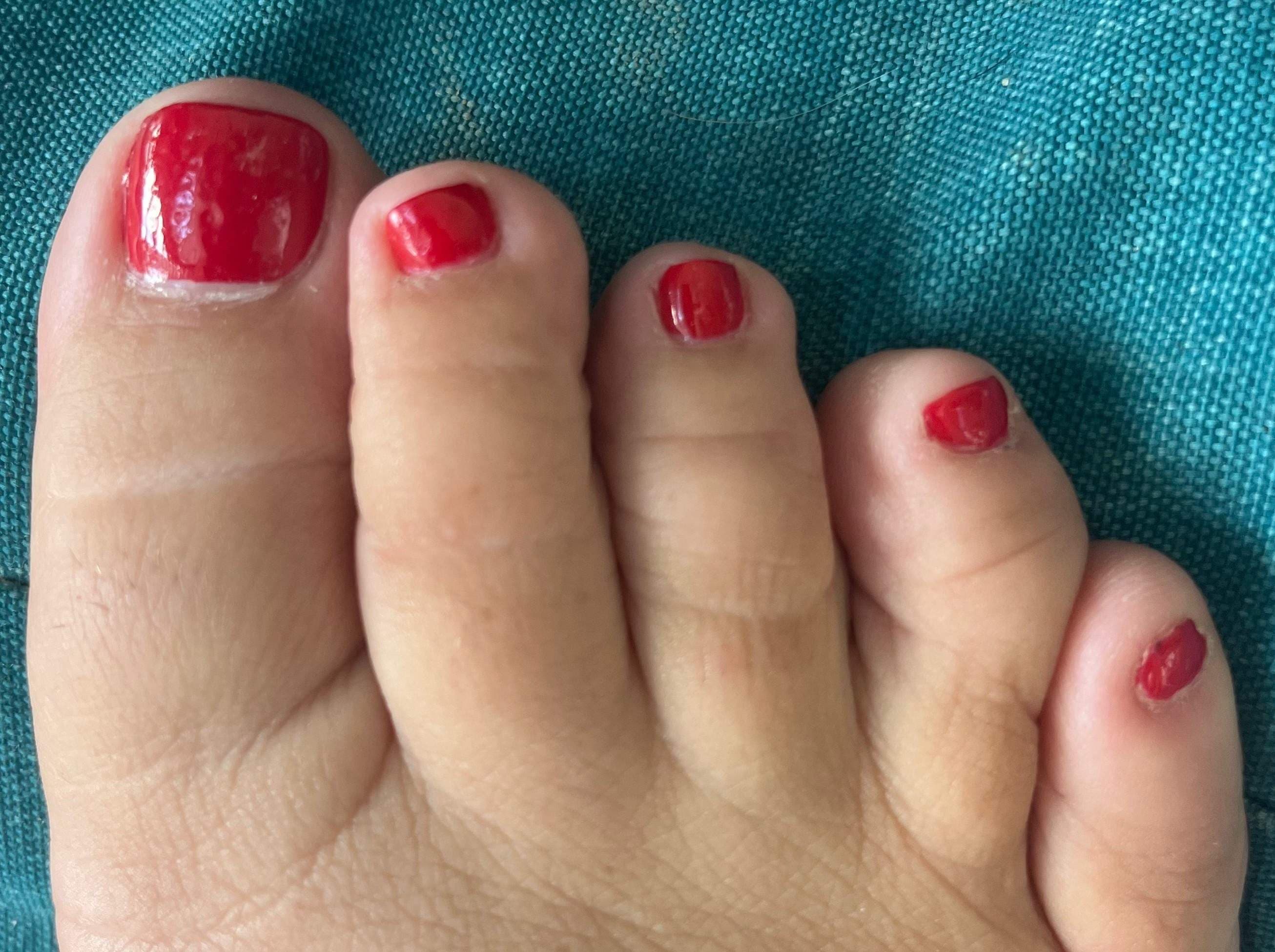 Twinkletoes