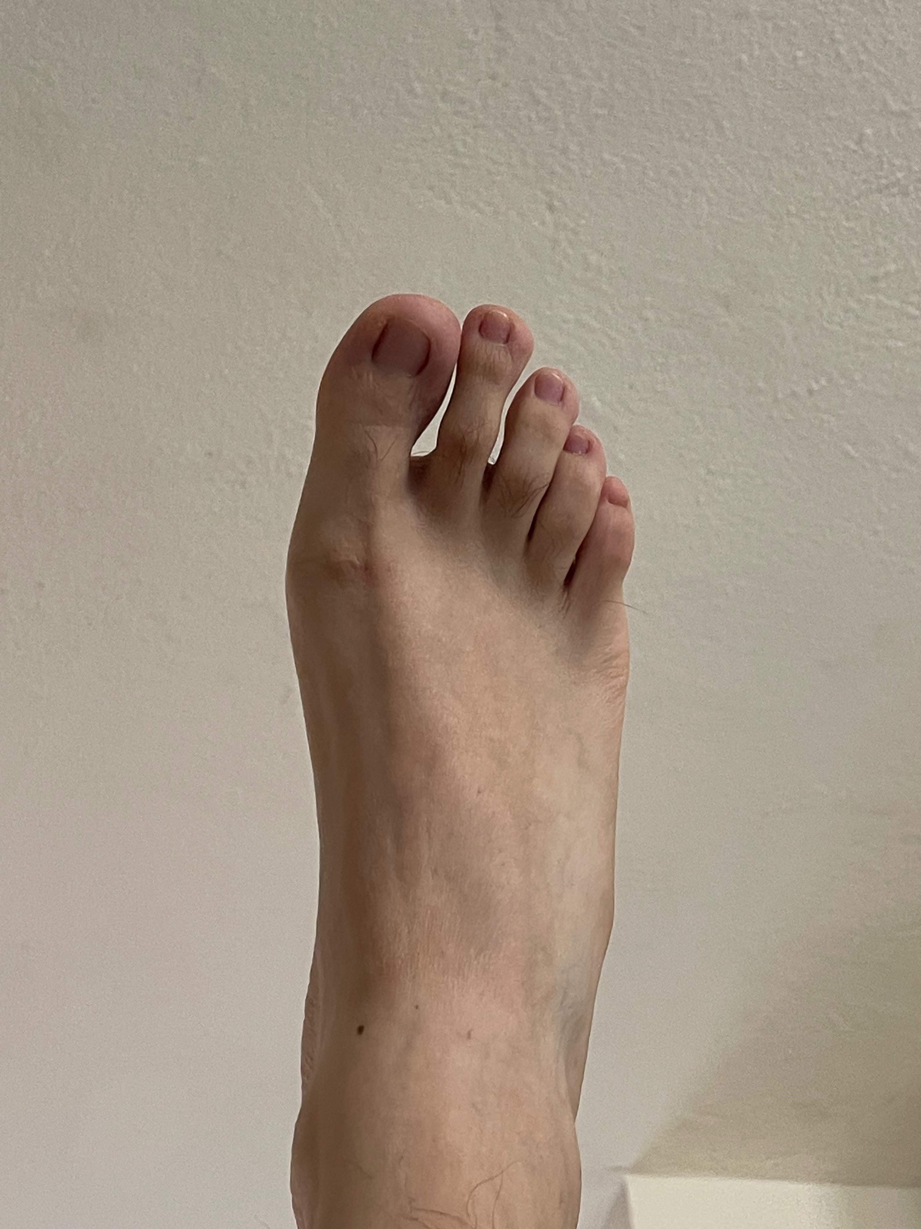 Feet and hairs