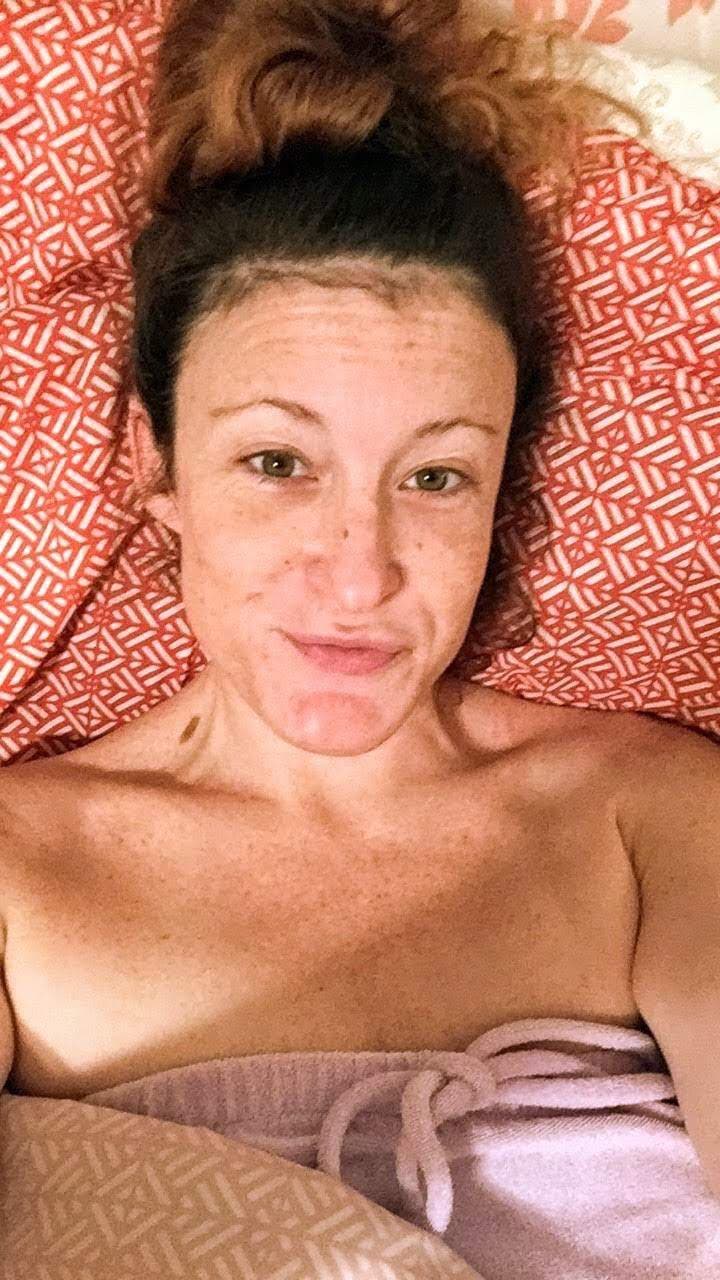 Redfreckles