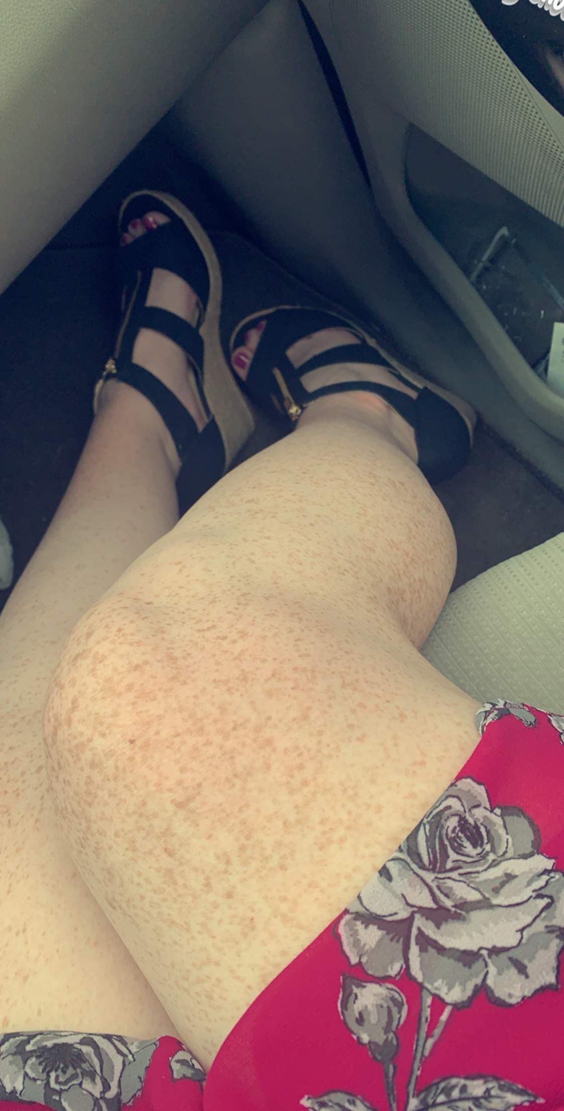 Freckled_Beauty