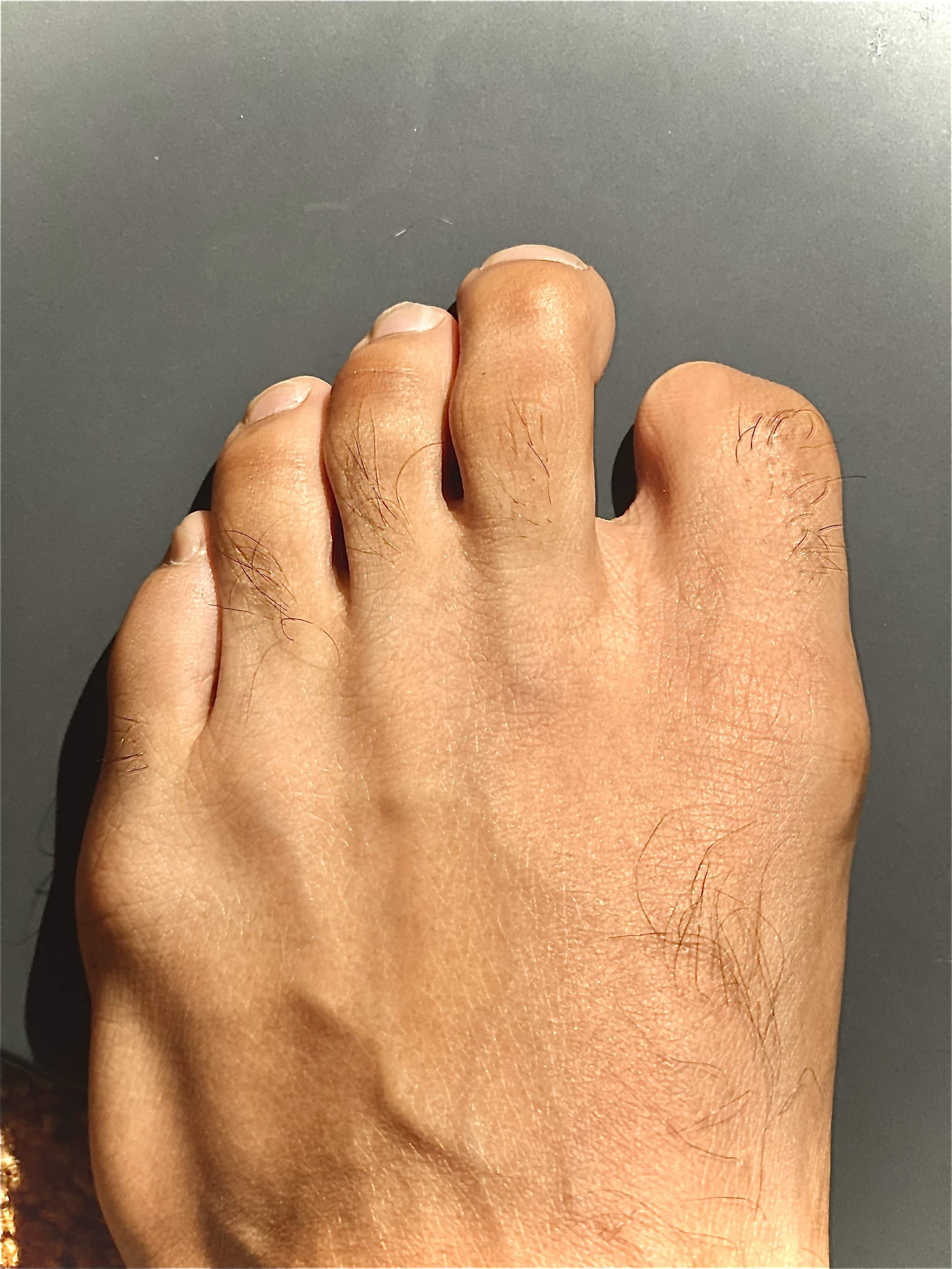 Lil Nug Foot