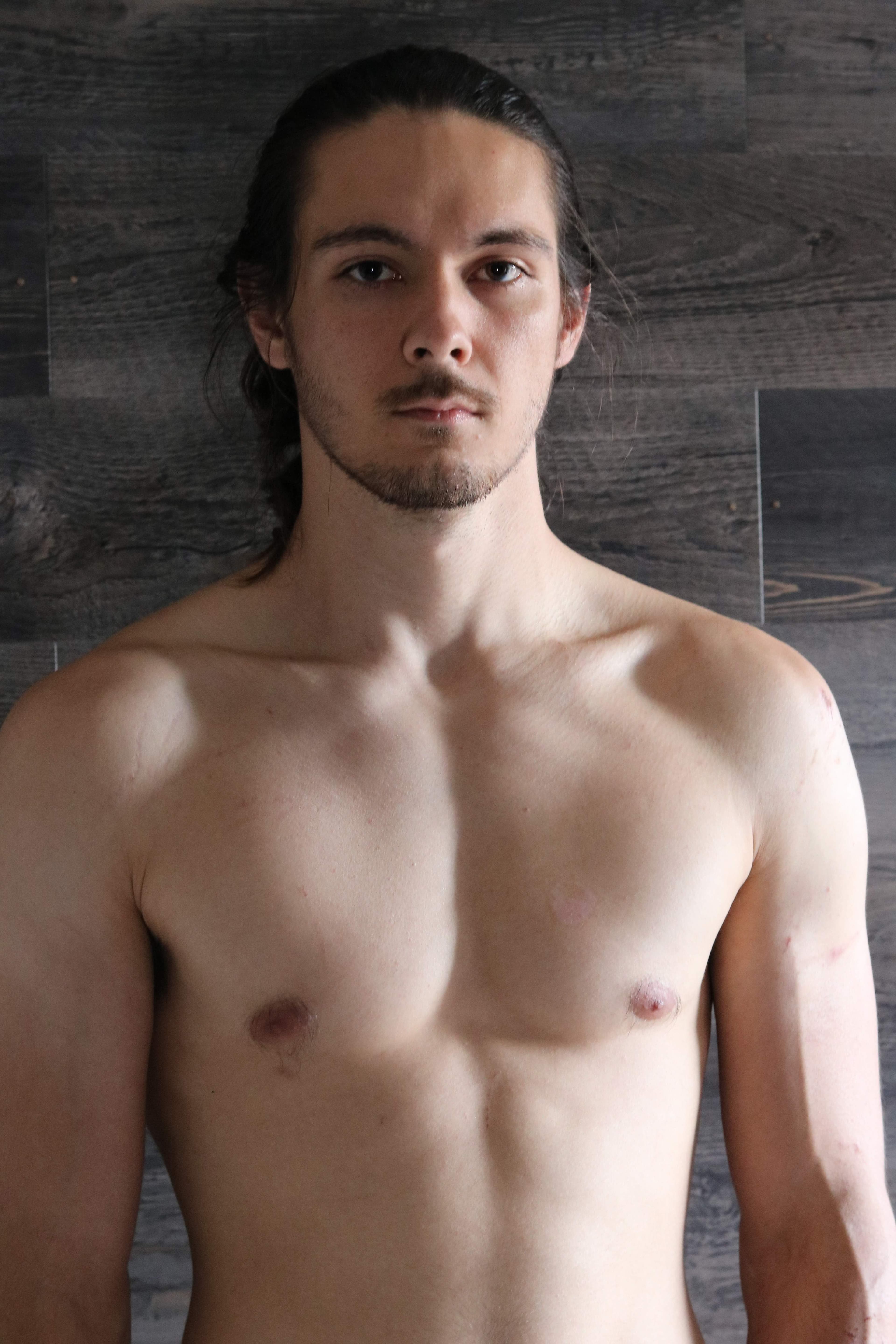 Keto Man