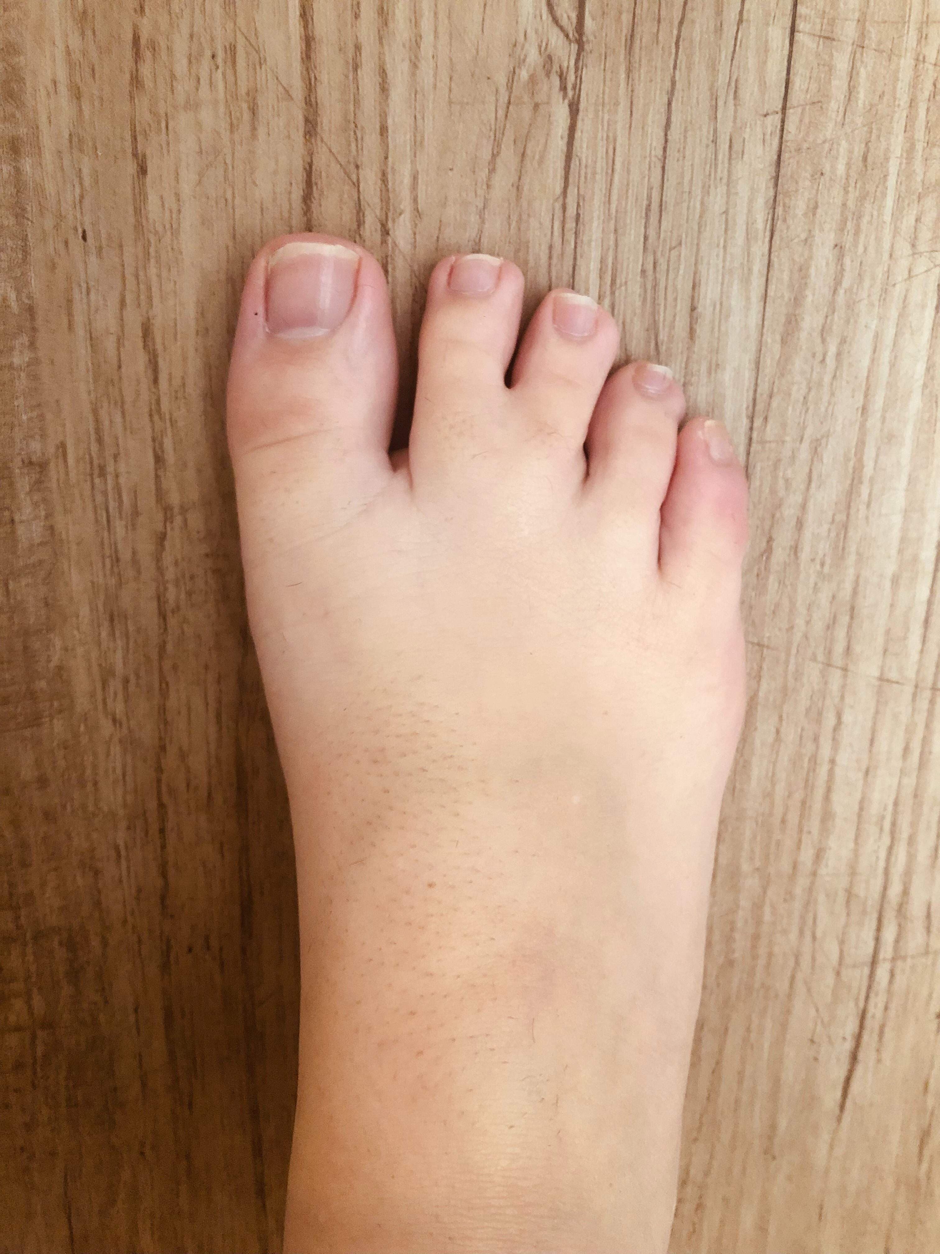Pigeon toe living