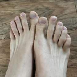 livinggayfeet