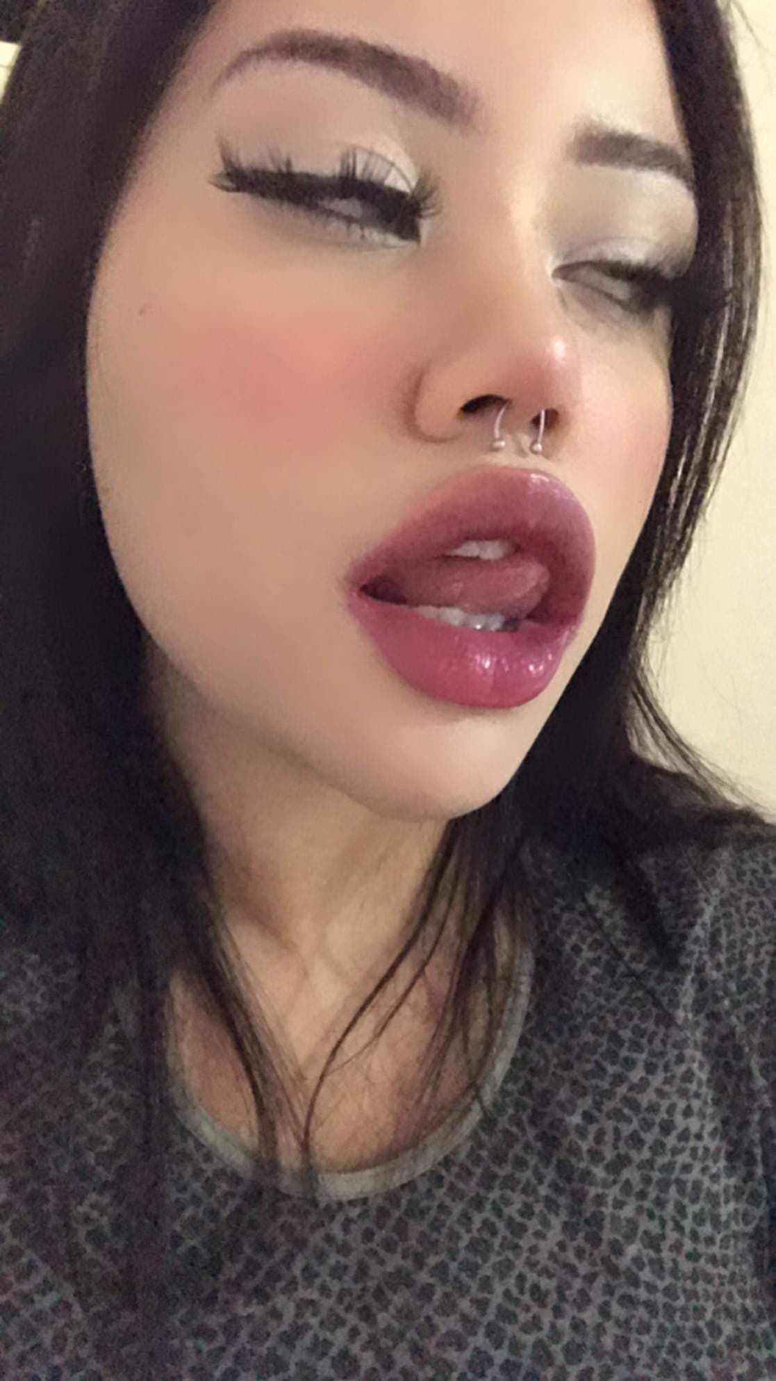 Poison