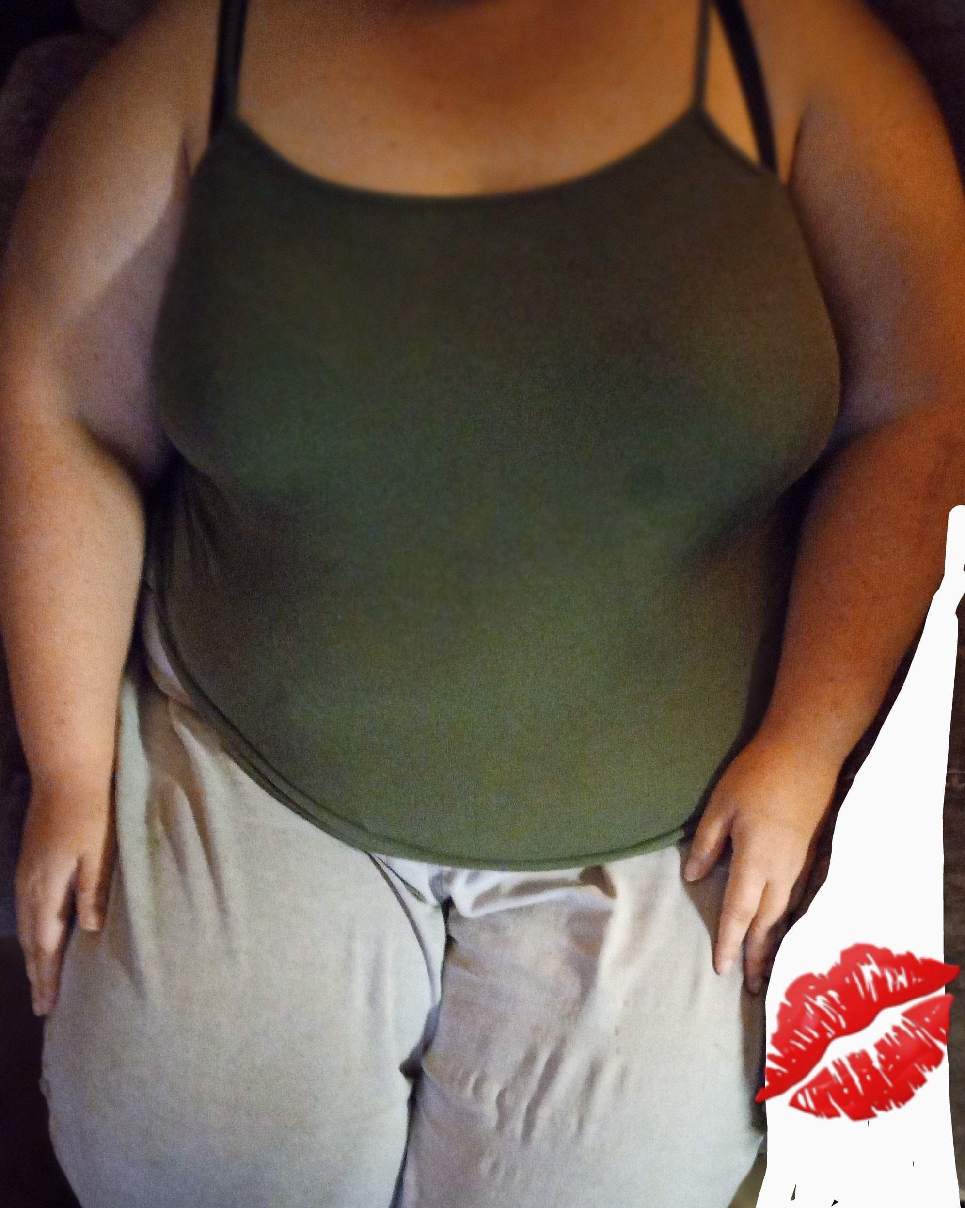 Amputee Mandy-Rae