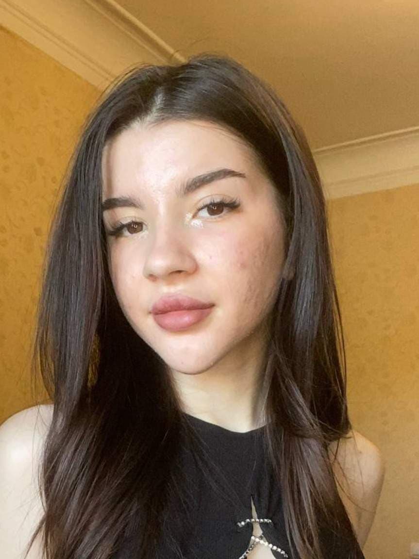 Lera SunRay🌞