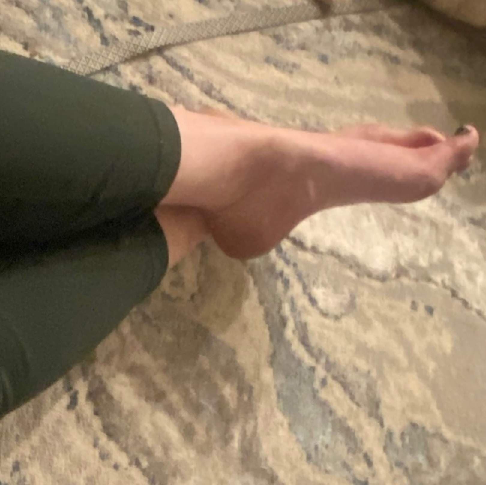 MBRR Toes