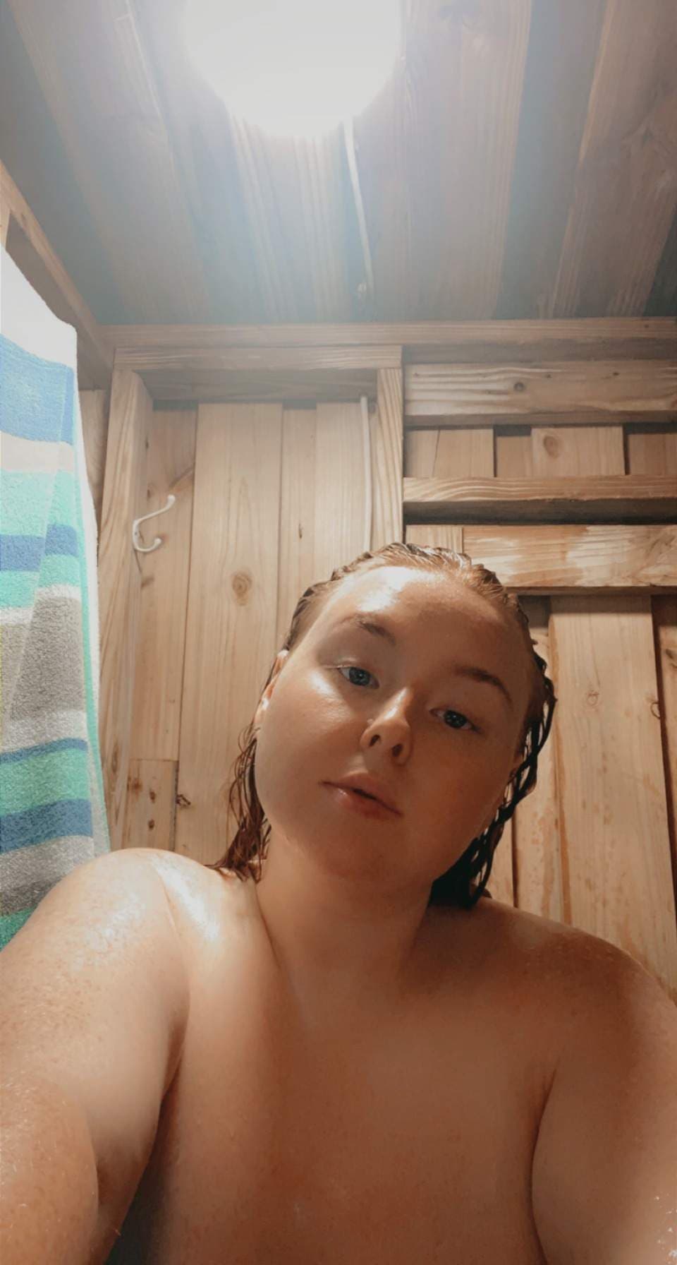 Freckles