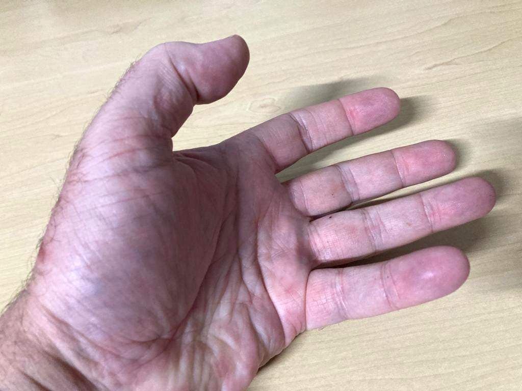The Hand