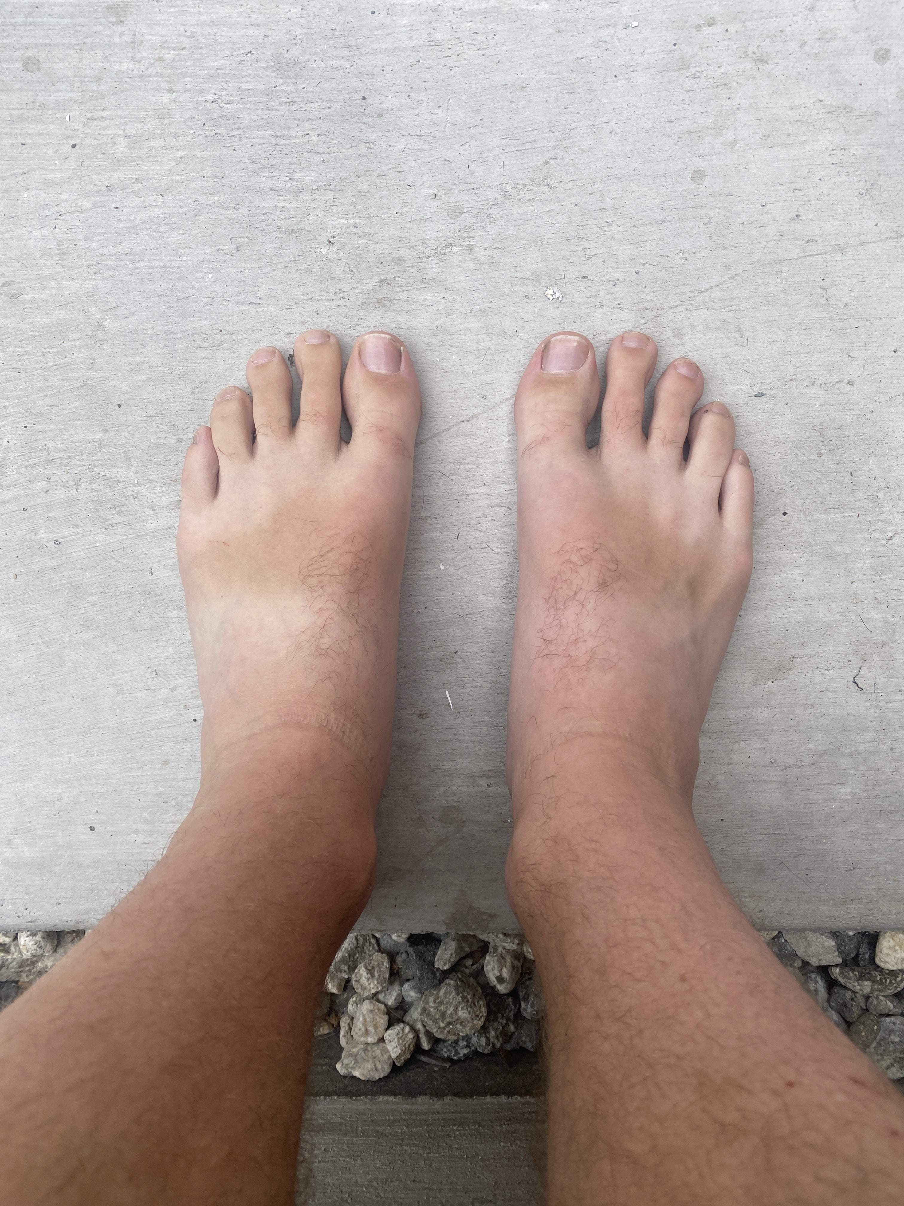 Guy with feet and toes