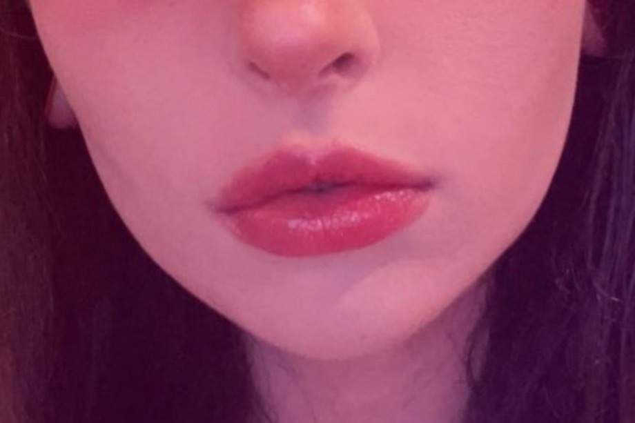Ur.Alt.Gf<3