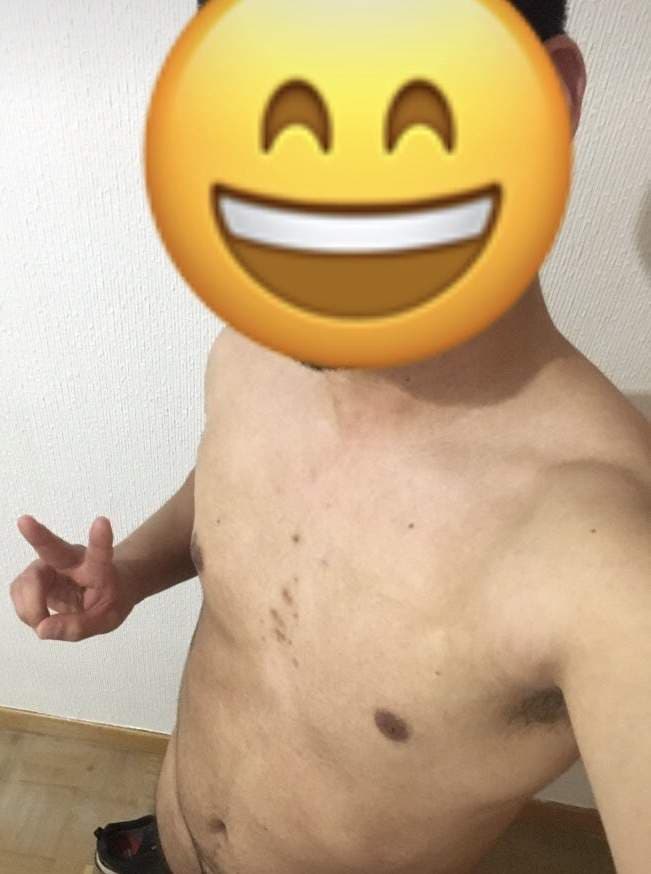 Leo