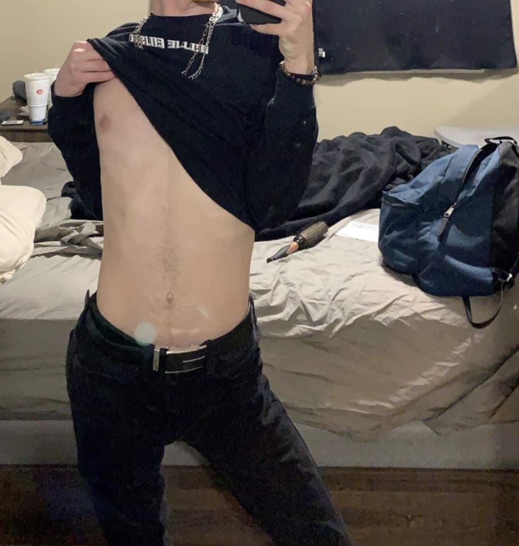 JJ