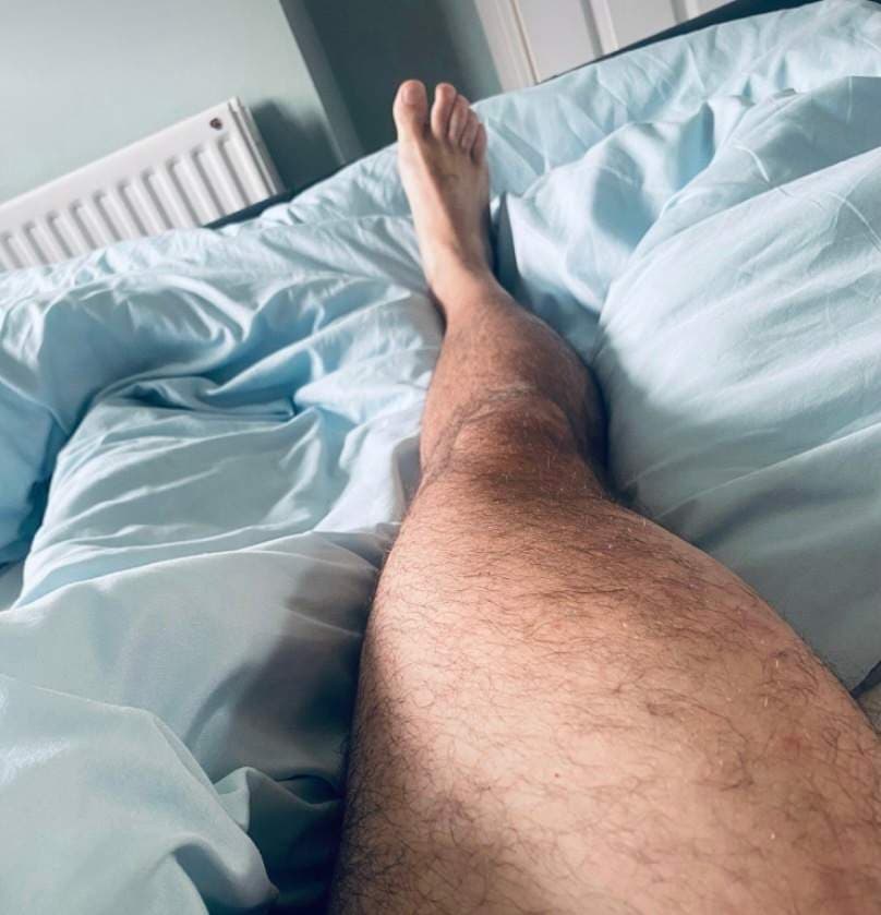 Thick Leg