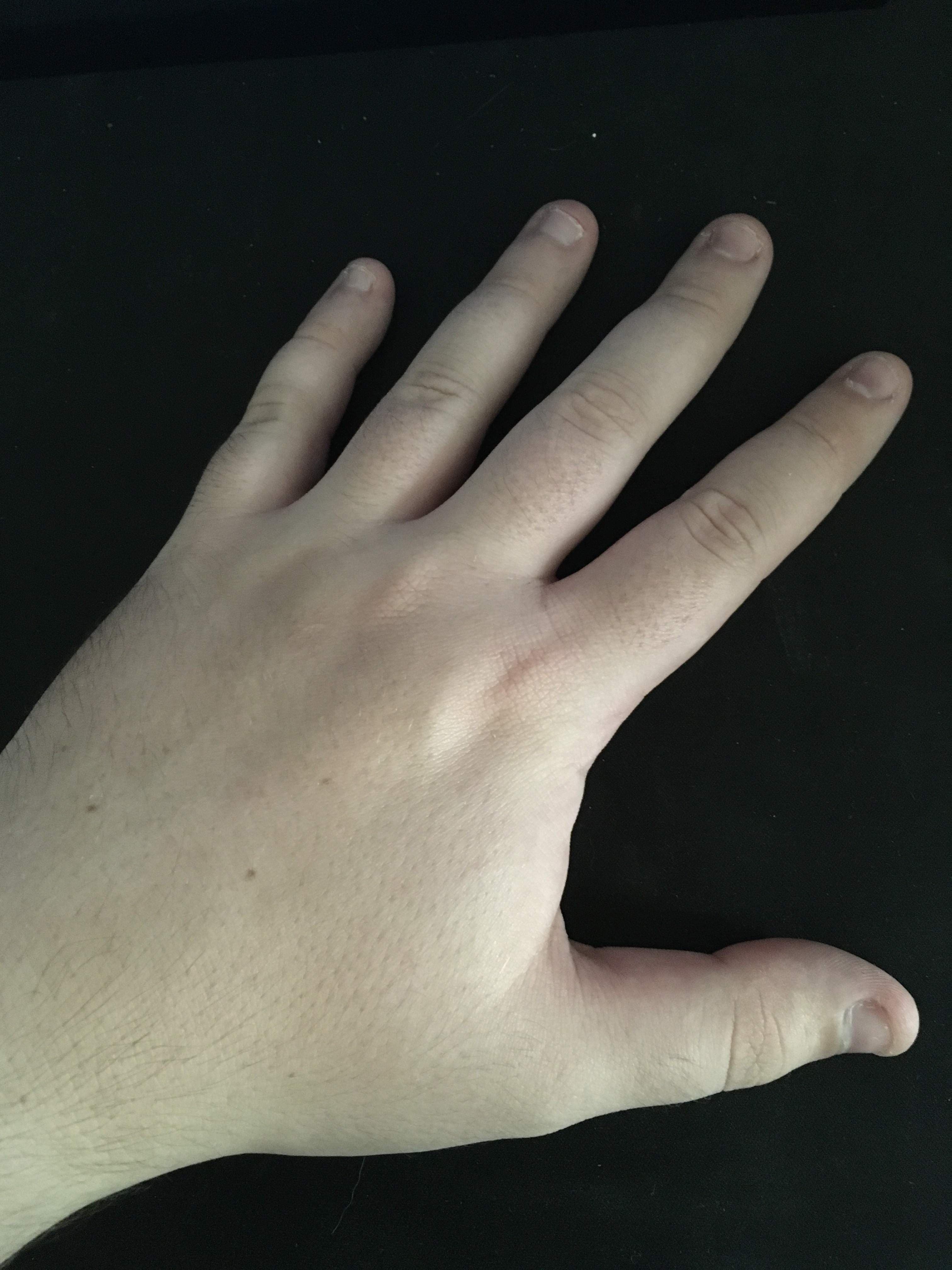 Only Fingers