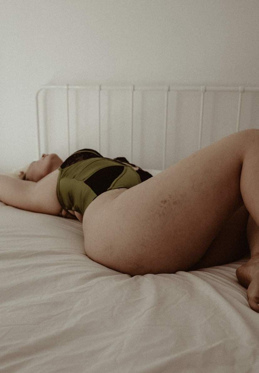 Marked Beauty