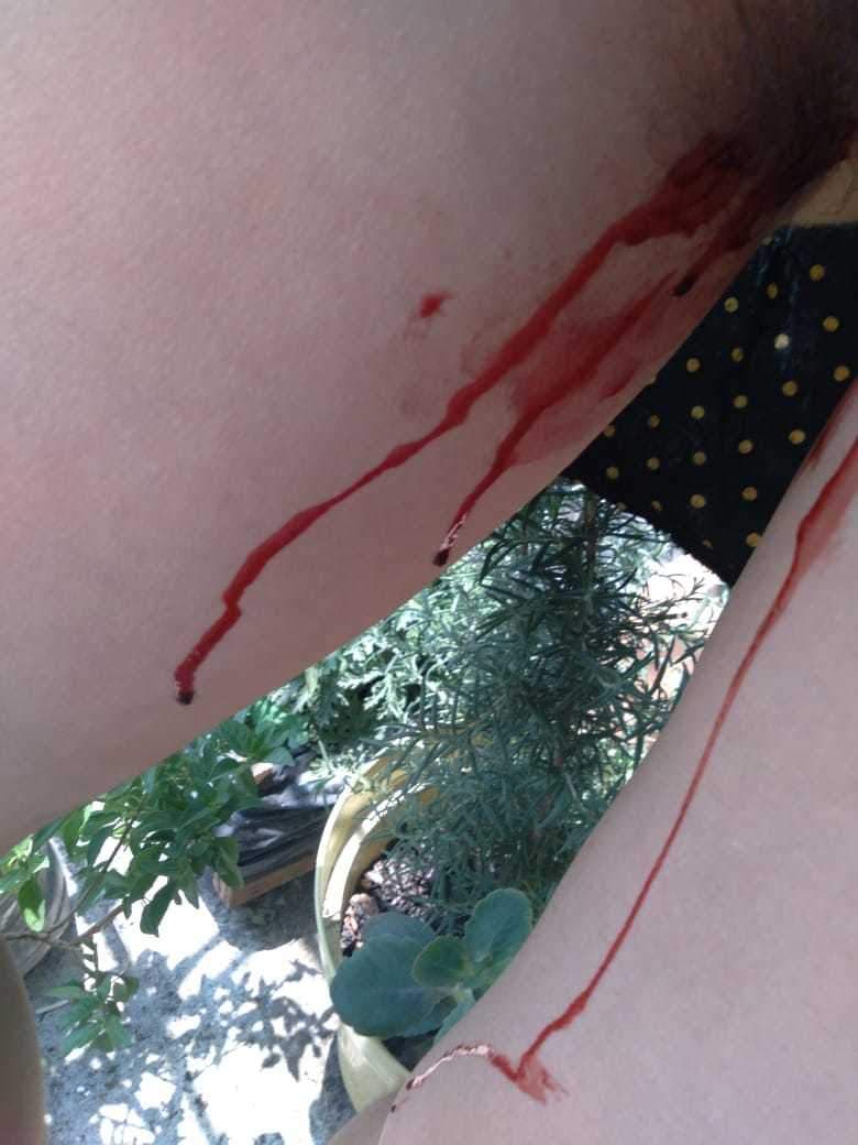 Bloody Godess