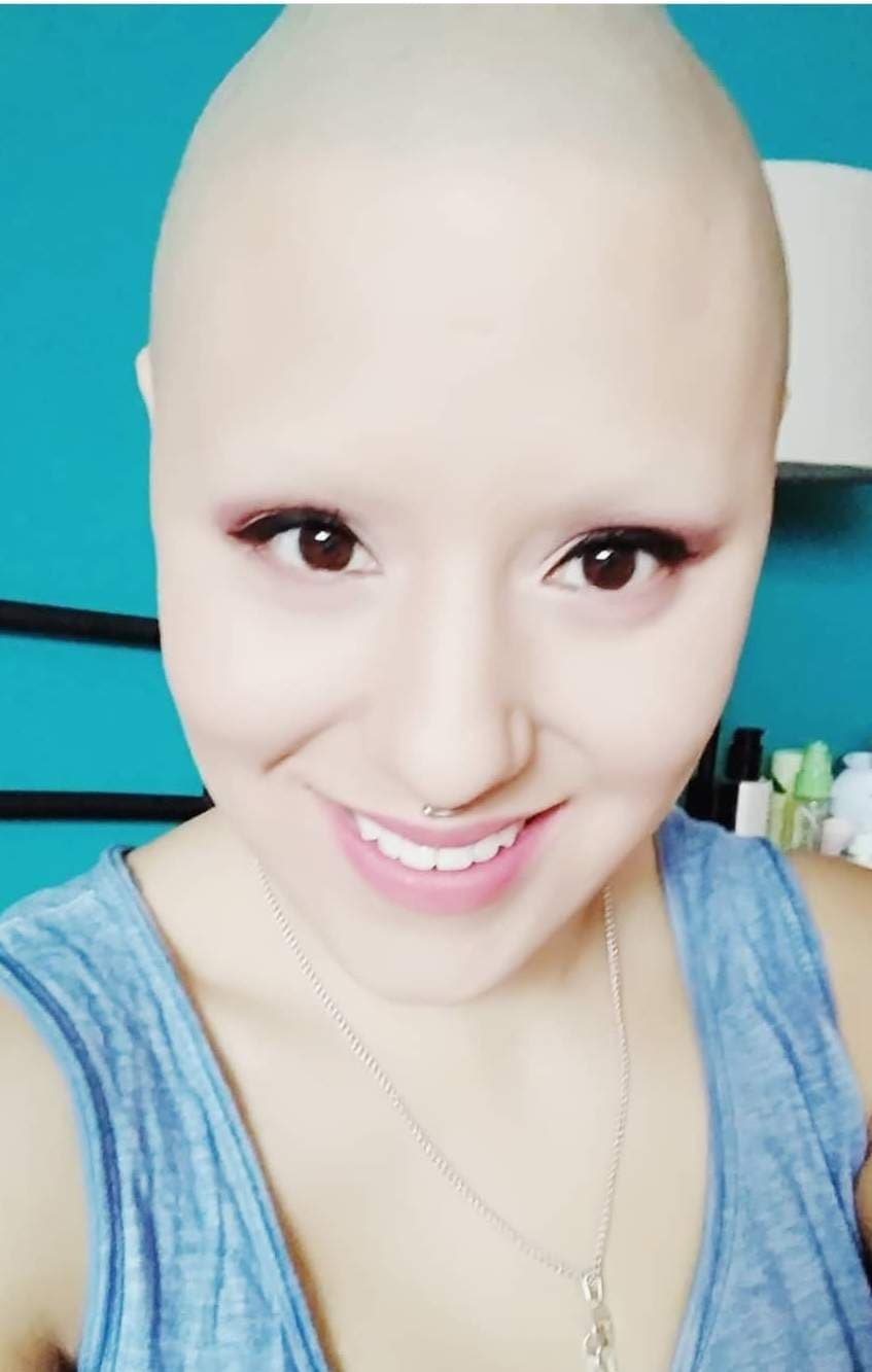 Baldscarmich