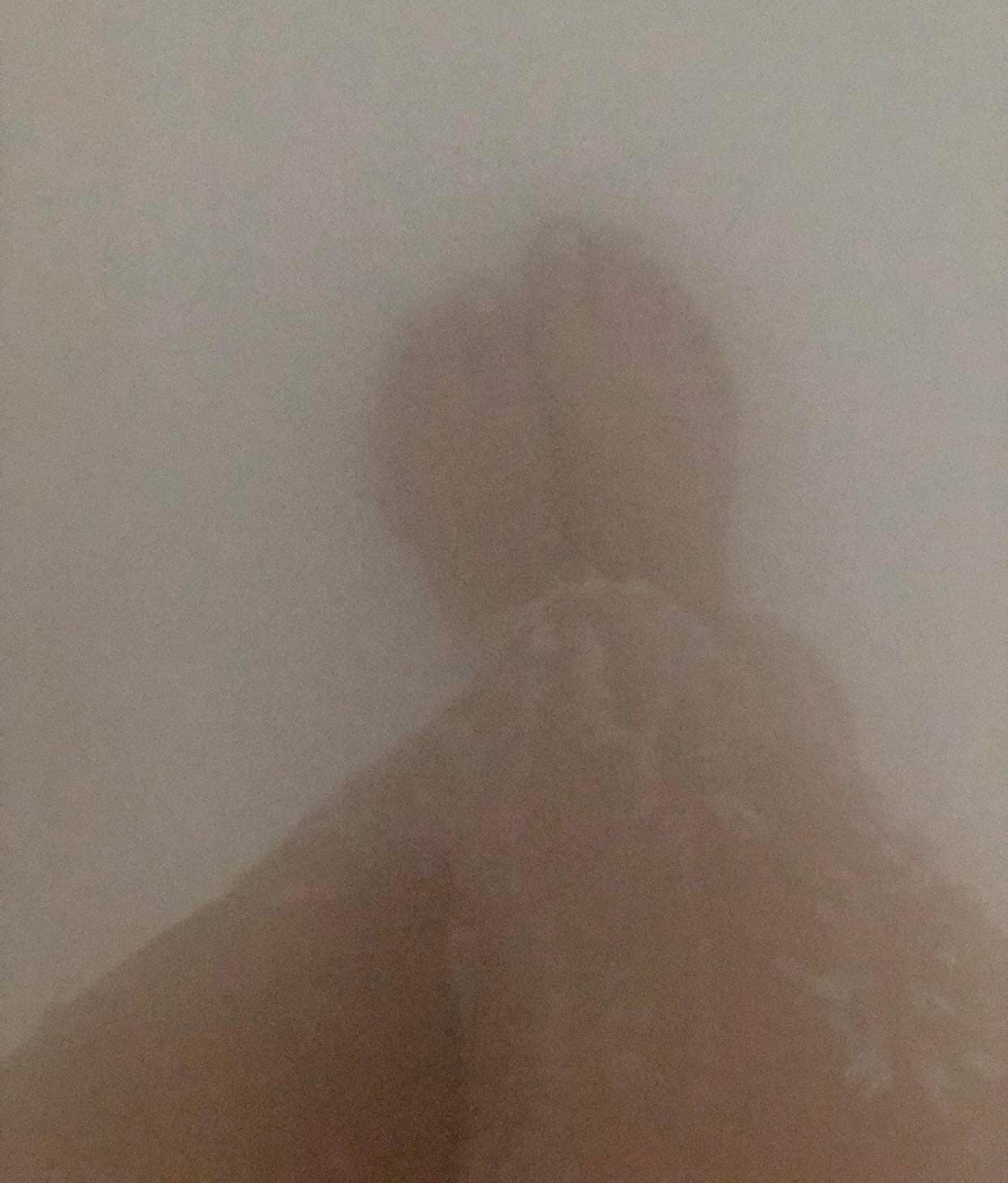 Legsfordays
