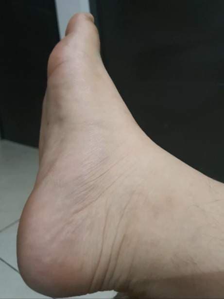 Mitos Jo