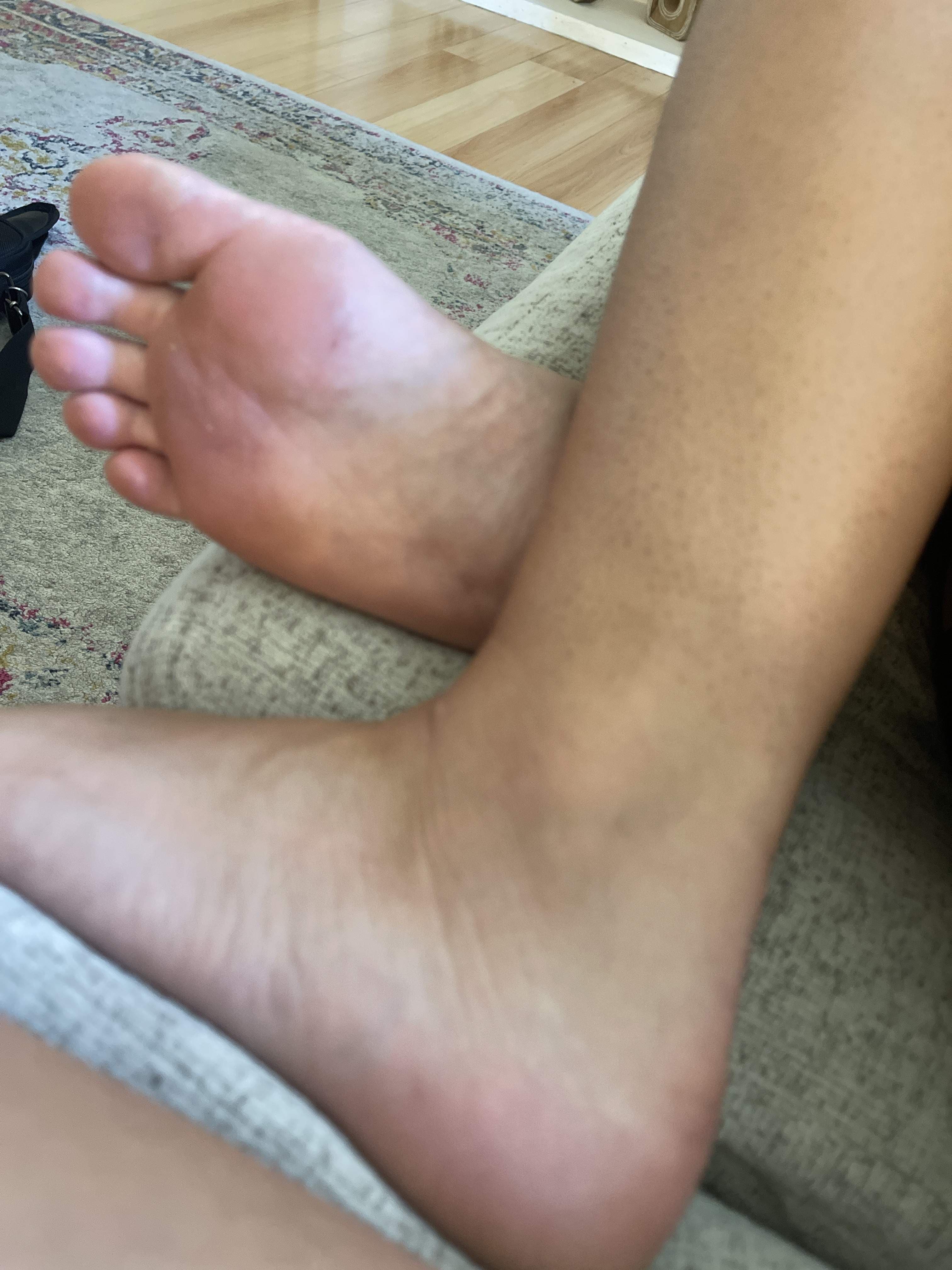 Juicy feet
