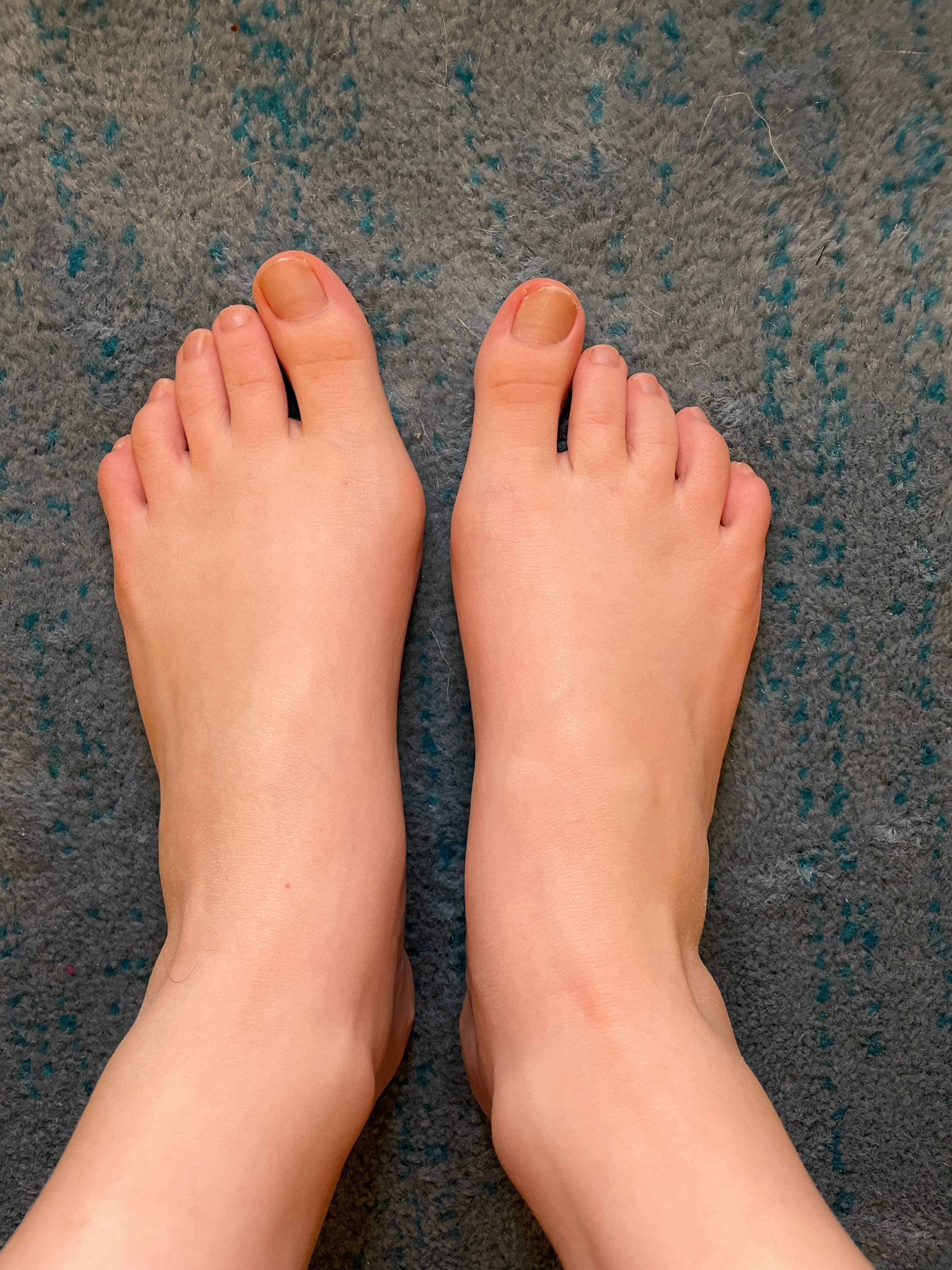 Jewish Toes