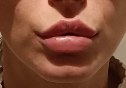 Sanela