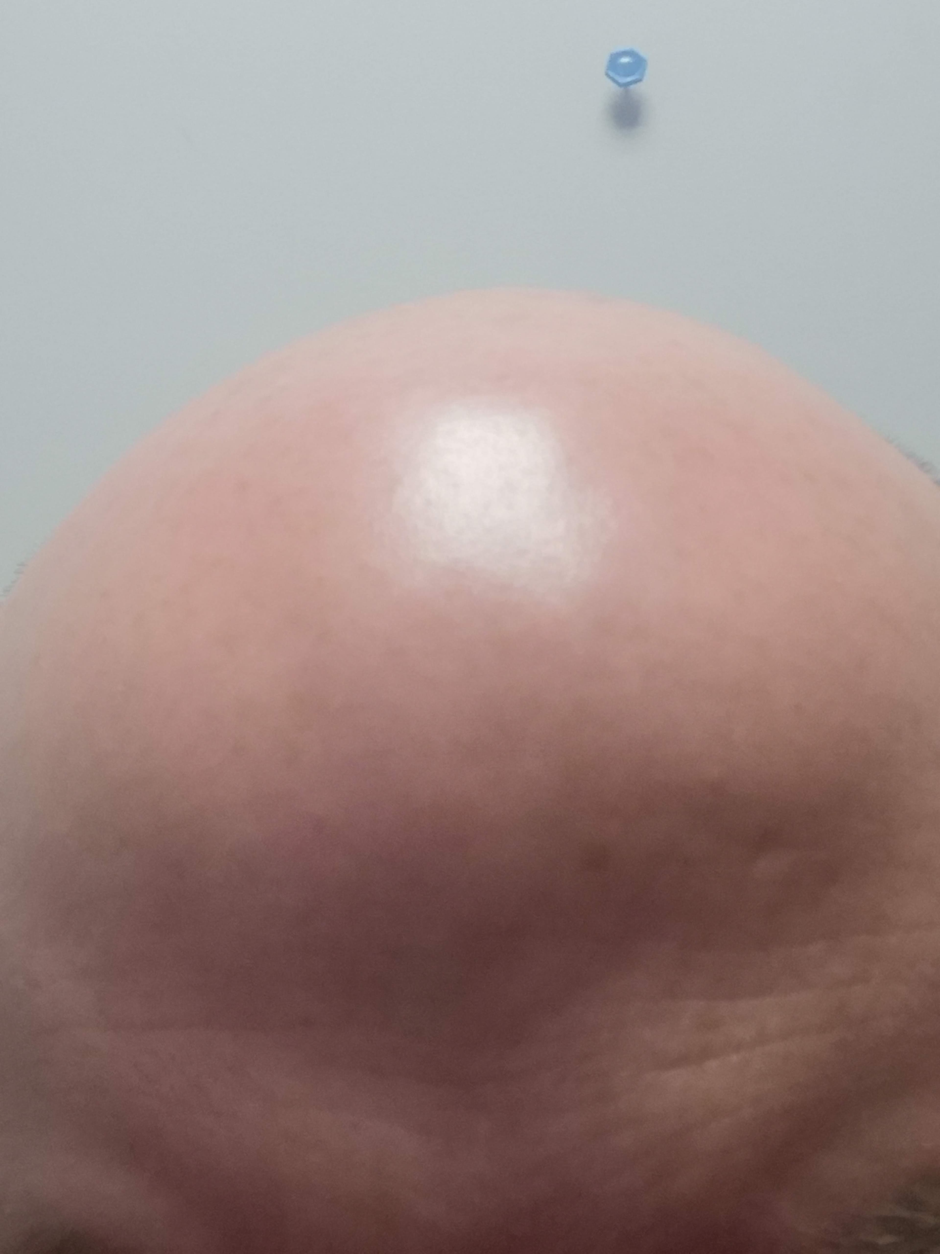 Baldy