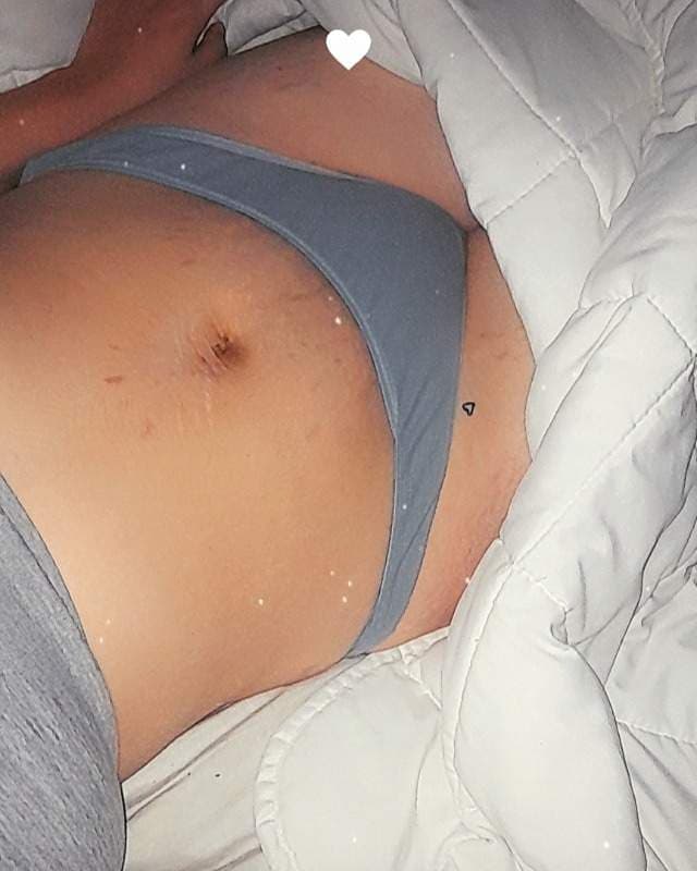 CC