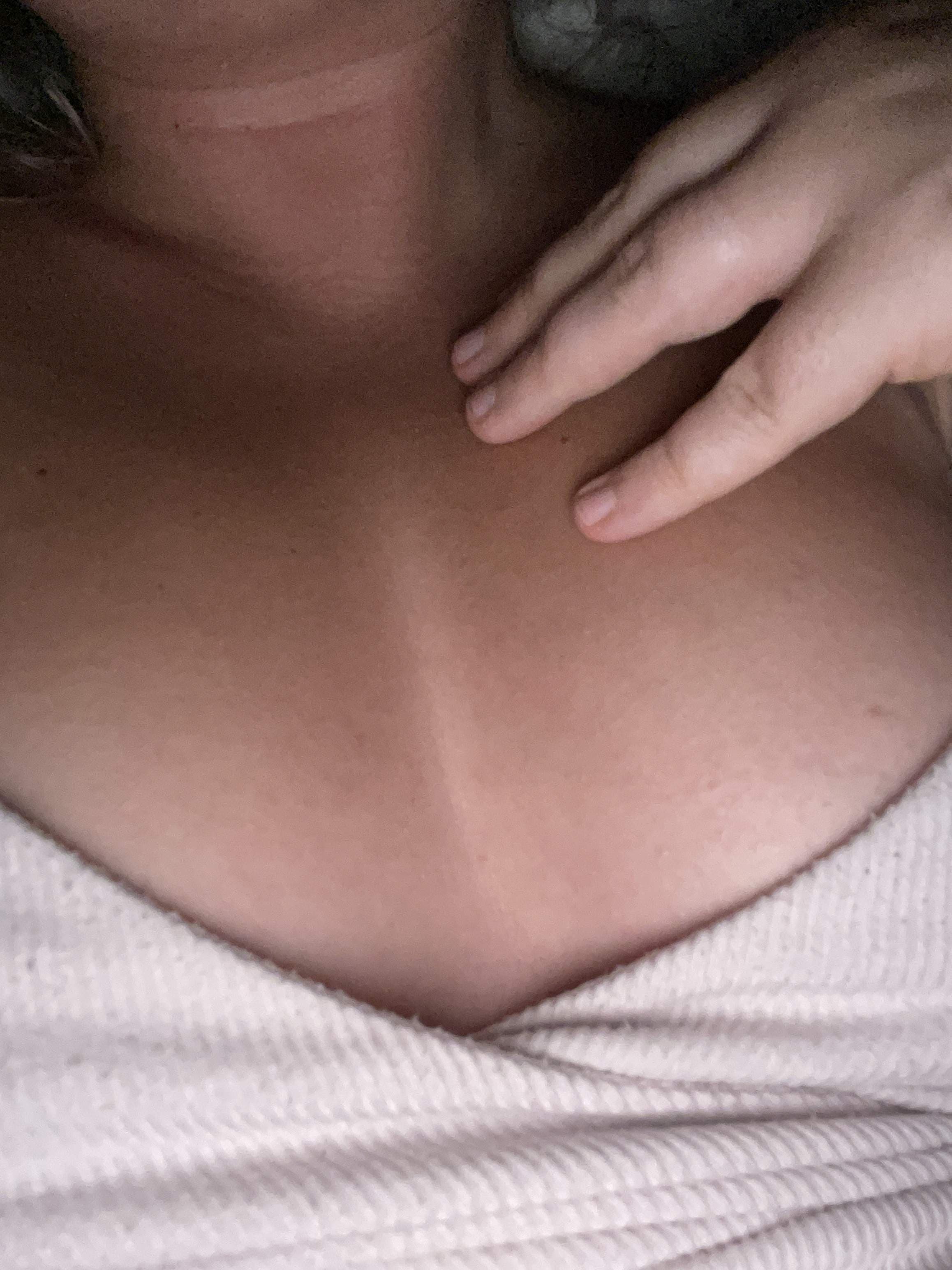 Orla