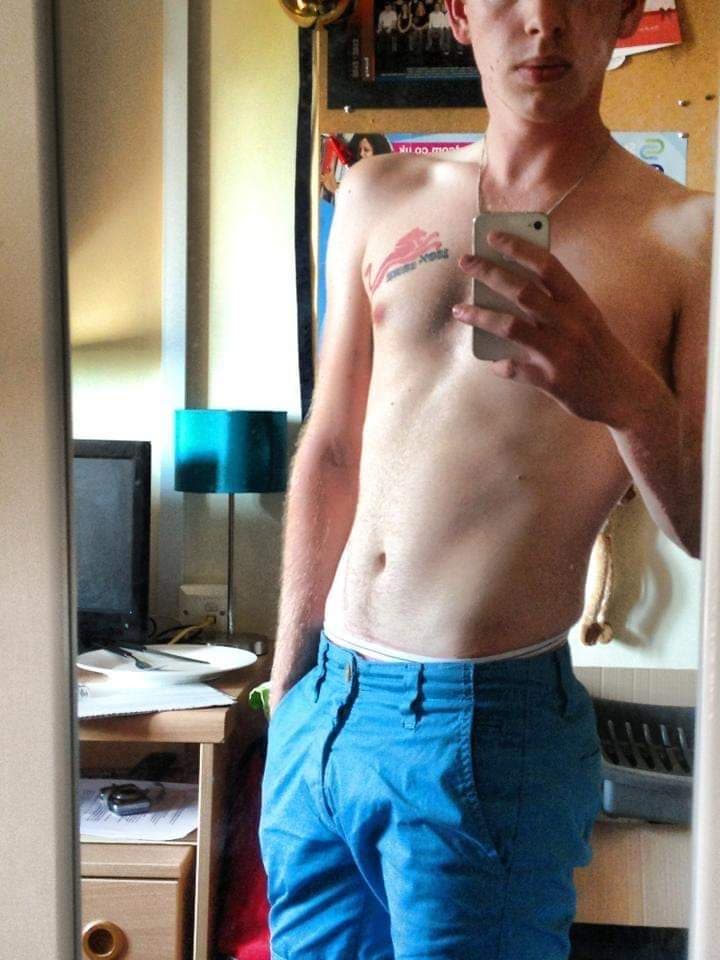 J