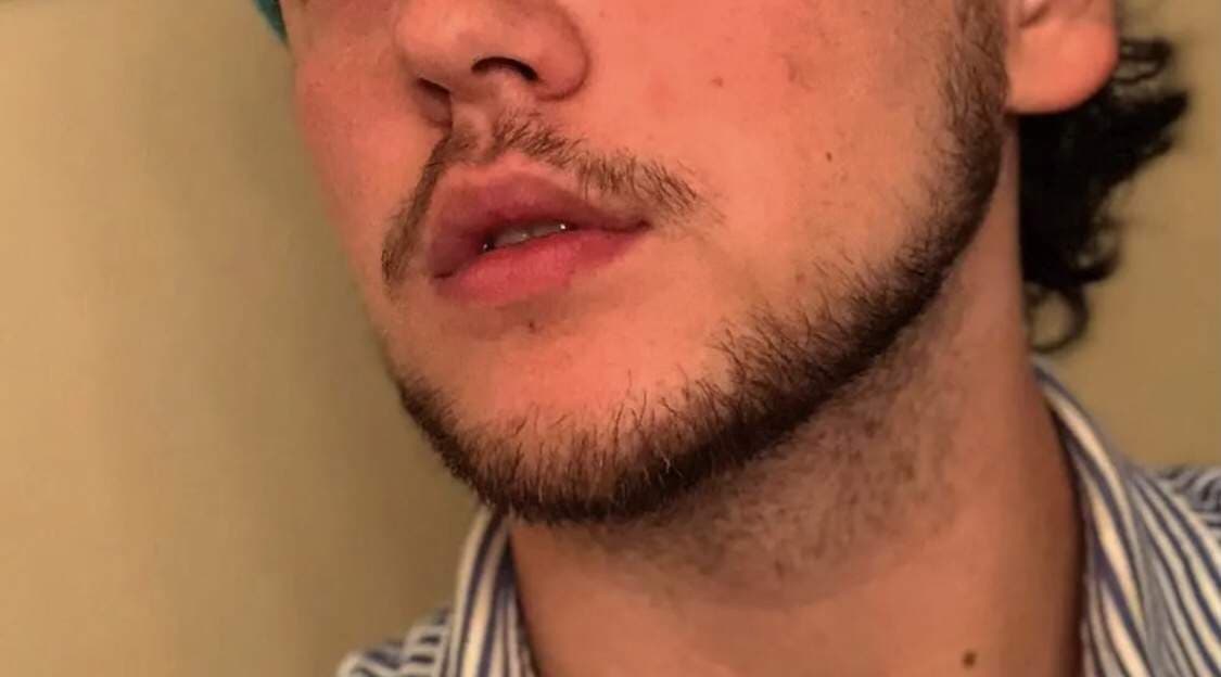 TRO