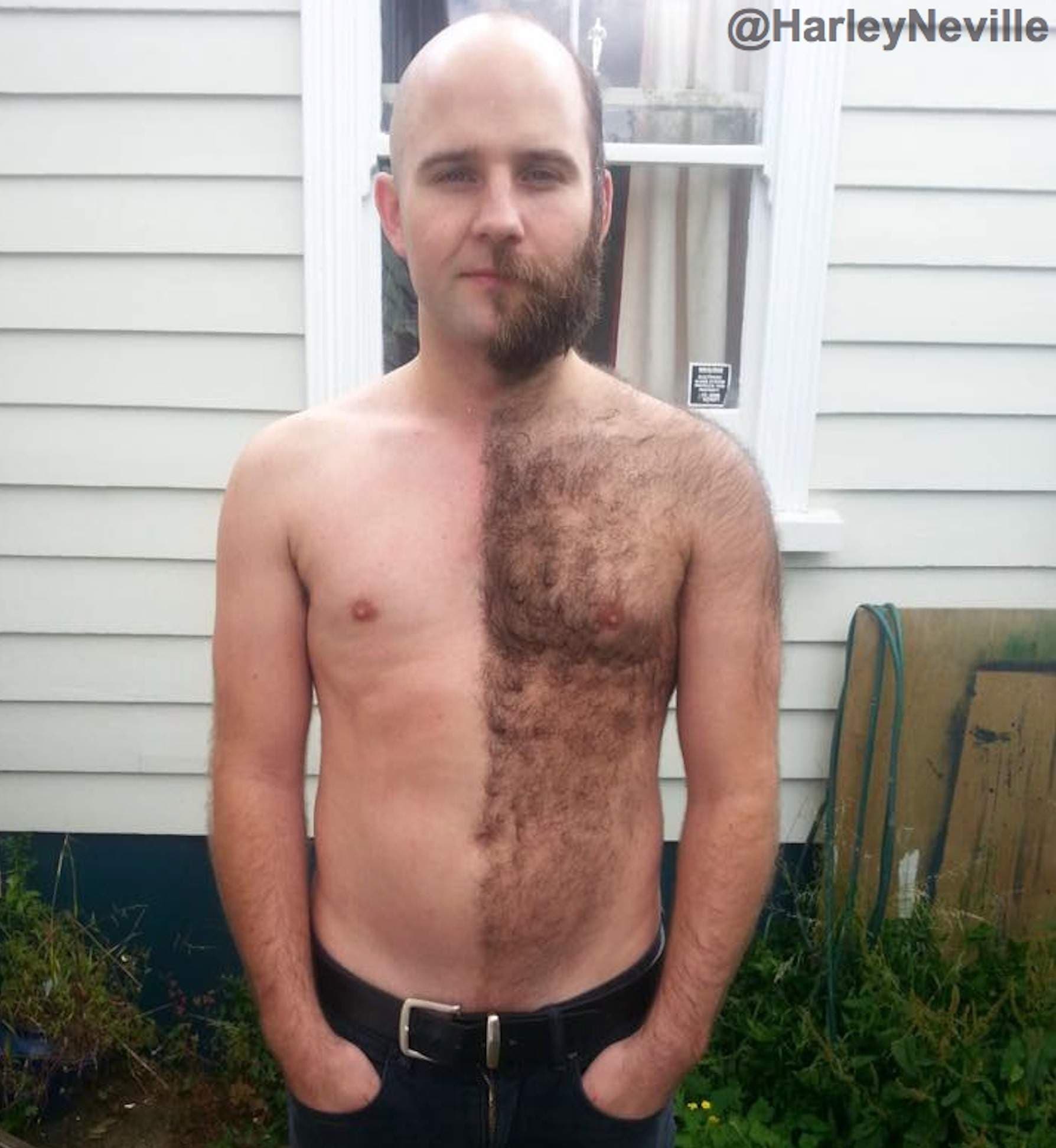 Hairy Navel