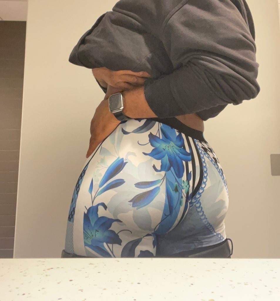Fatty