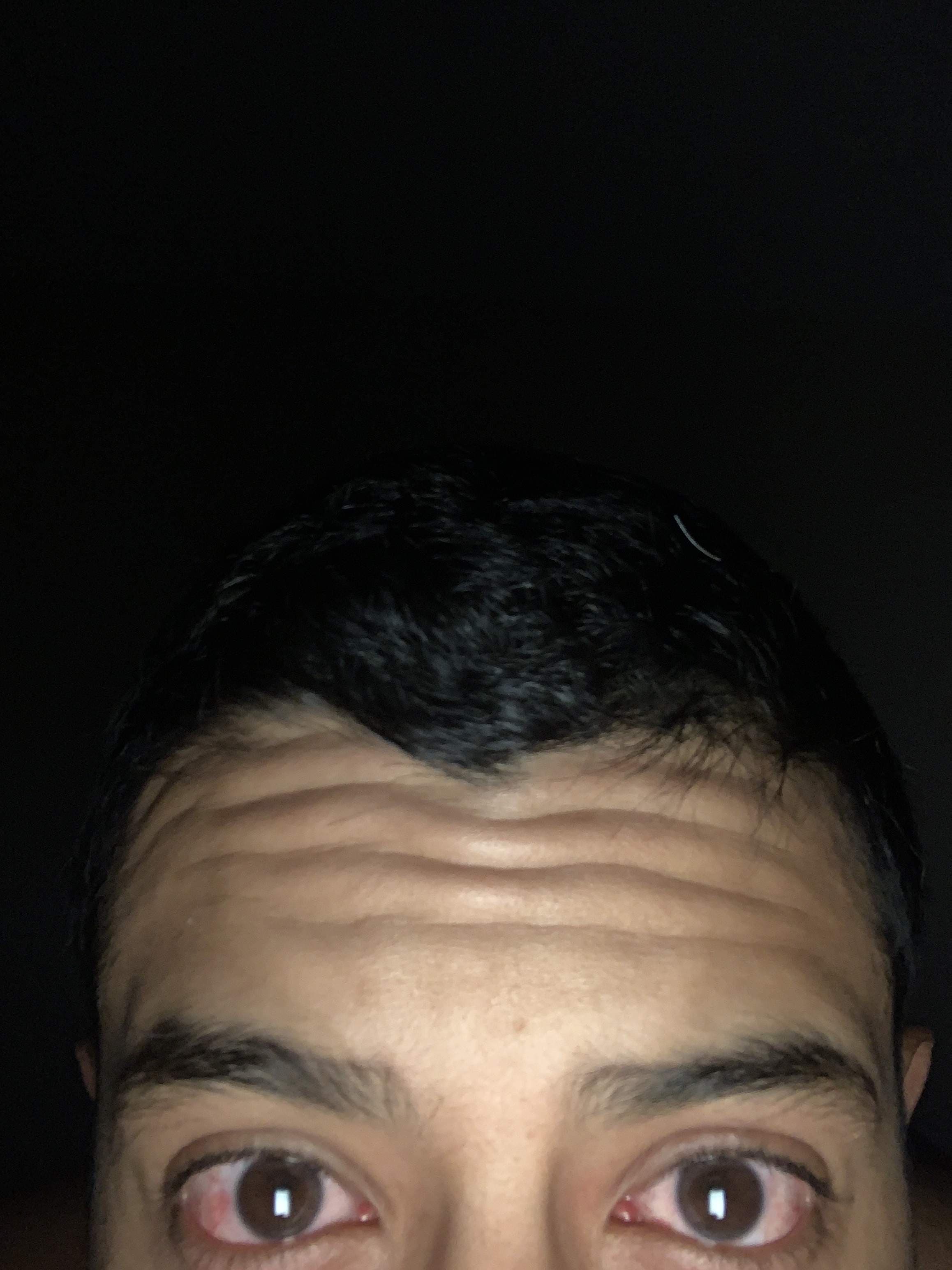 Sirnips
